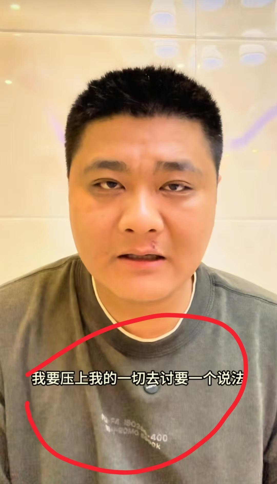 看到朱进从小被生父母弃养，我忍了
看到他养家接连遭遇两次车祸丧亲的变故，我也忍了