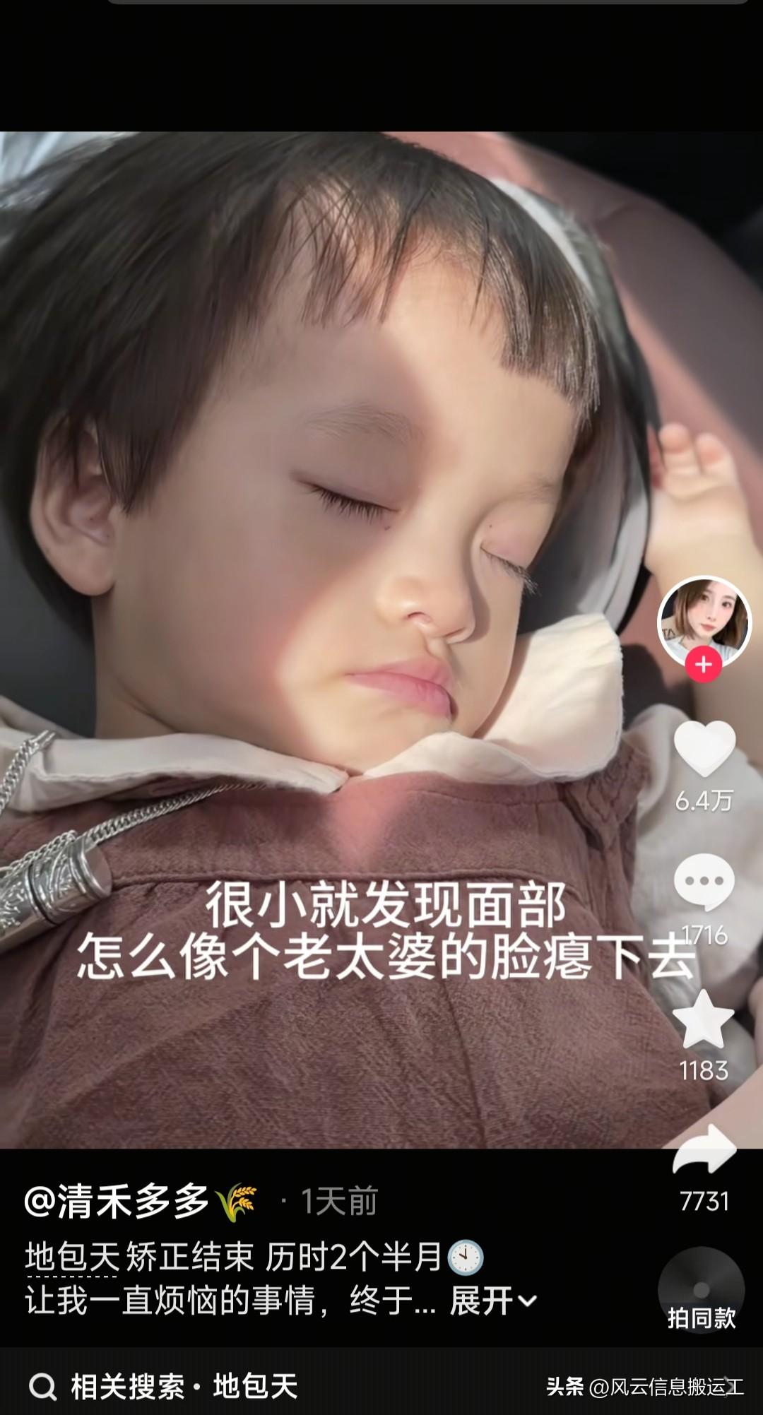 看一个小女孩的地包天矫正视频，你们猜花了多少钱就搞定了？

才1800，两个半月