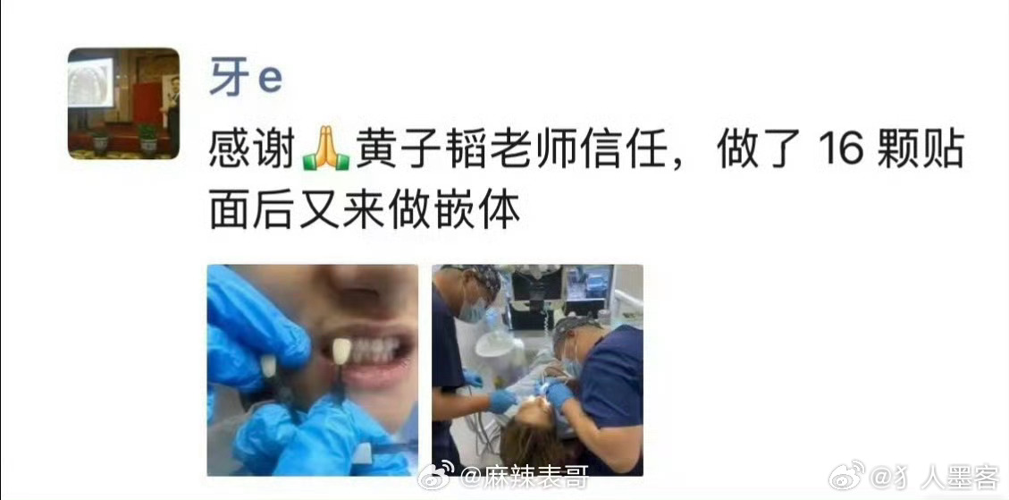 黄子韬怒斥偷拍牙医人还是要有一些道德底线 