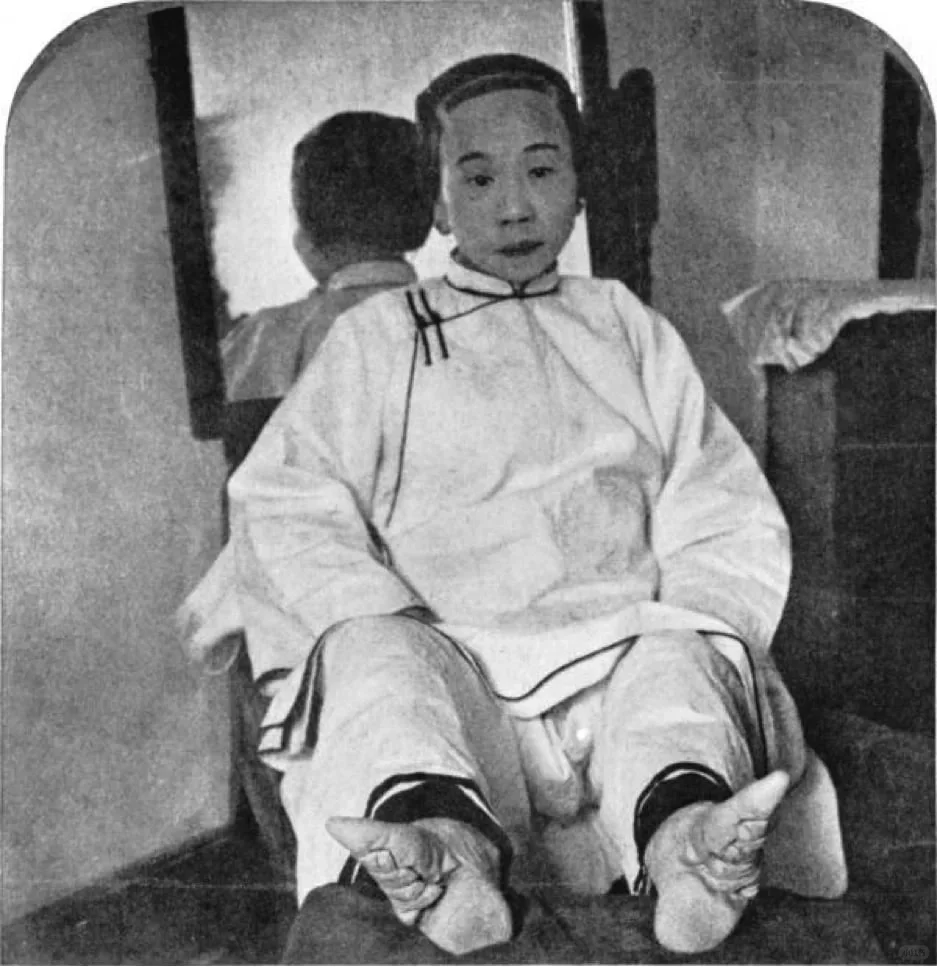 19世纪末，一位从小裹小脚的中国女士。