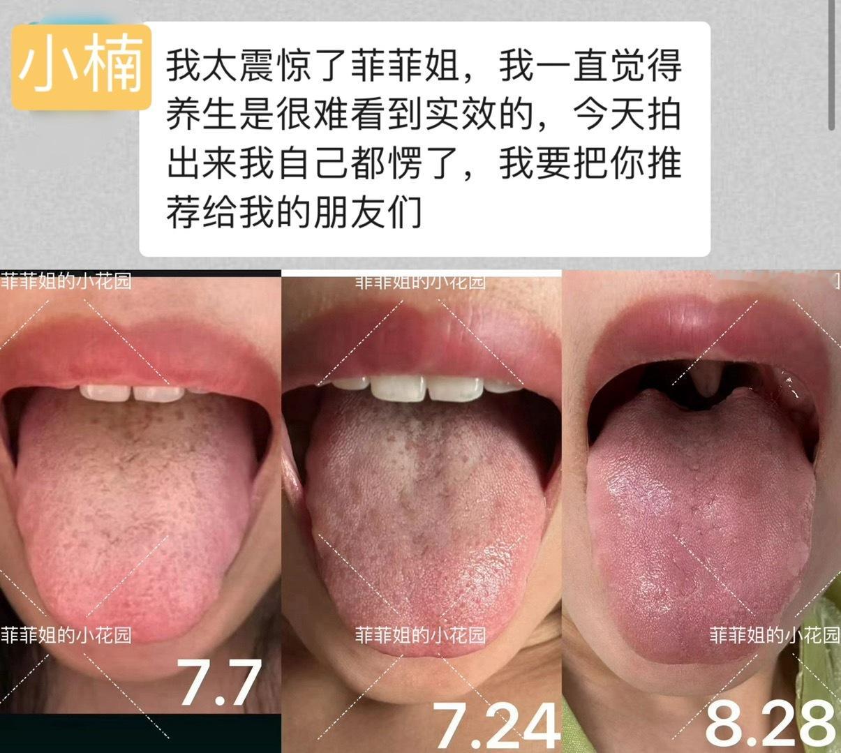 #菲菲姐的三伏营# 40天，简直换了一个人小楠说：震惊了！想不到养生这么有效！小