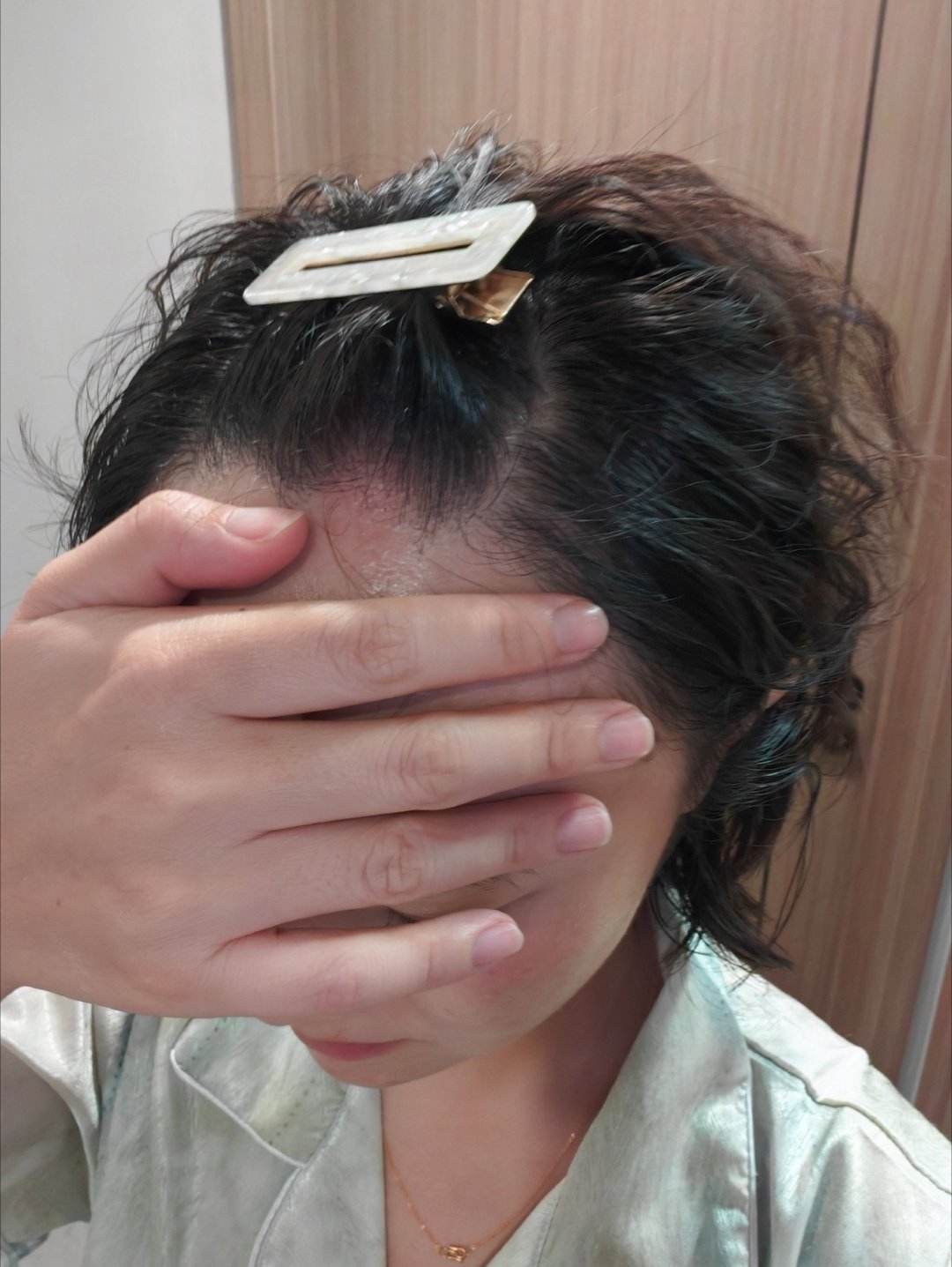 谁想到我这1米五的个子也能撞到脑门，还给撞了个包呢 
