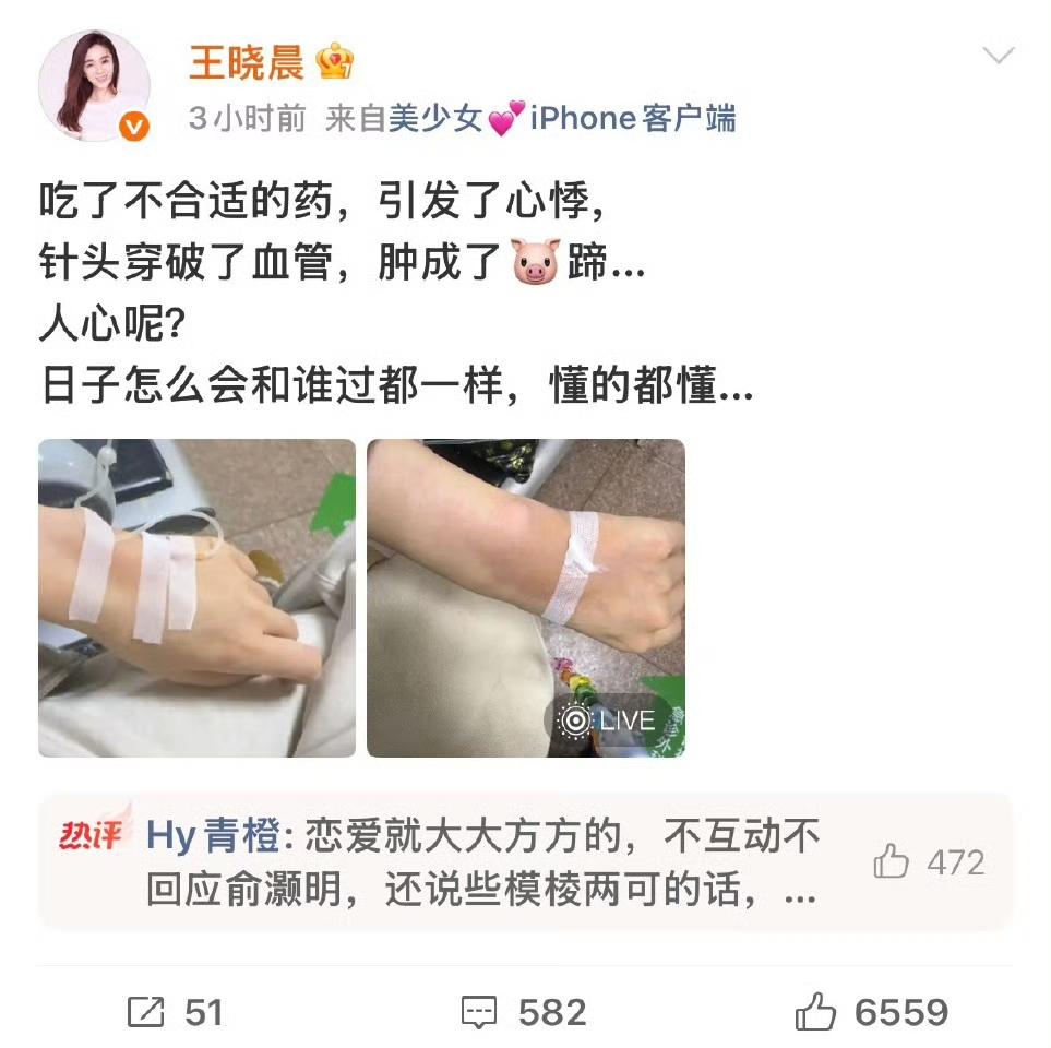4月13日，王晓晨发文称自己吃了不合适的药，导致心悸就医，还晒出了一只手在输液的