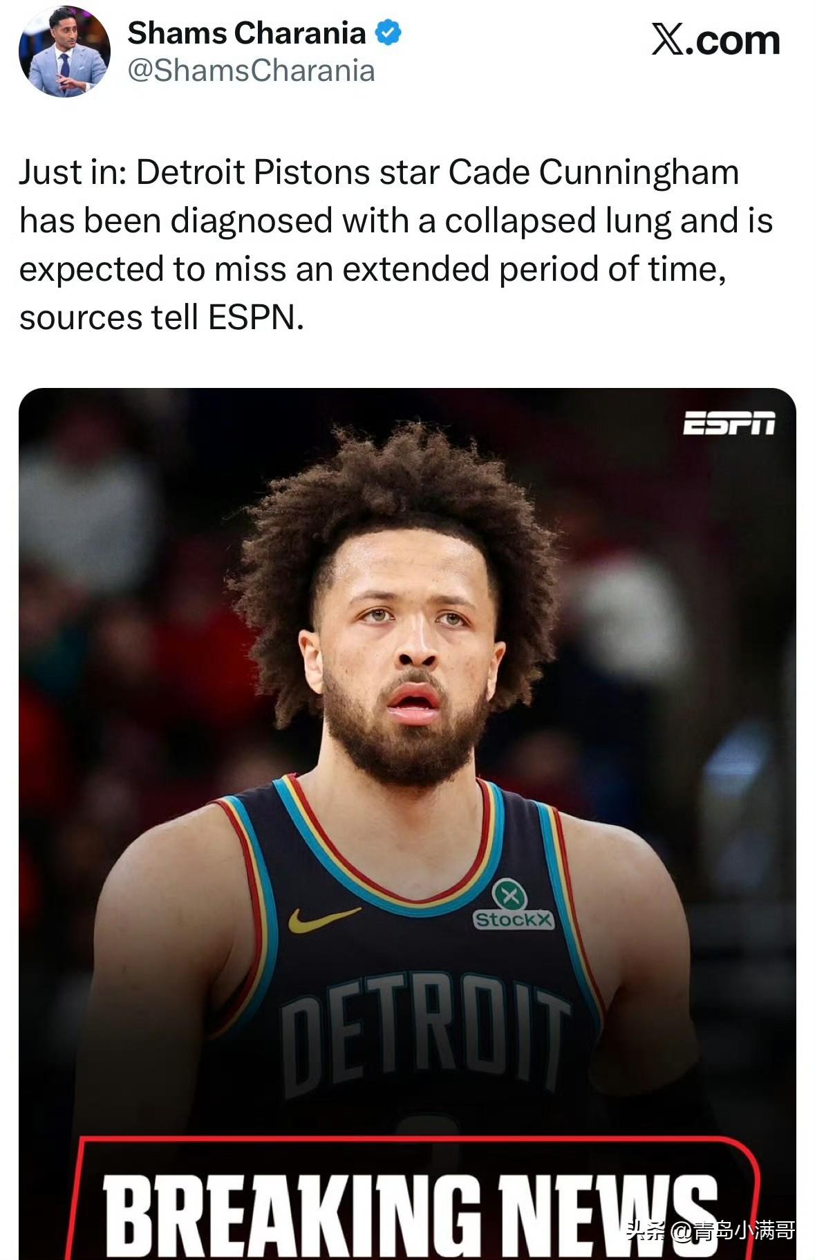 东部第一遭重创！！！活塞核心坎宁安确诊气胸，常规赛或报销！可爱多一点，干爽多一点