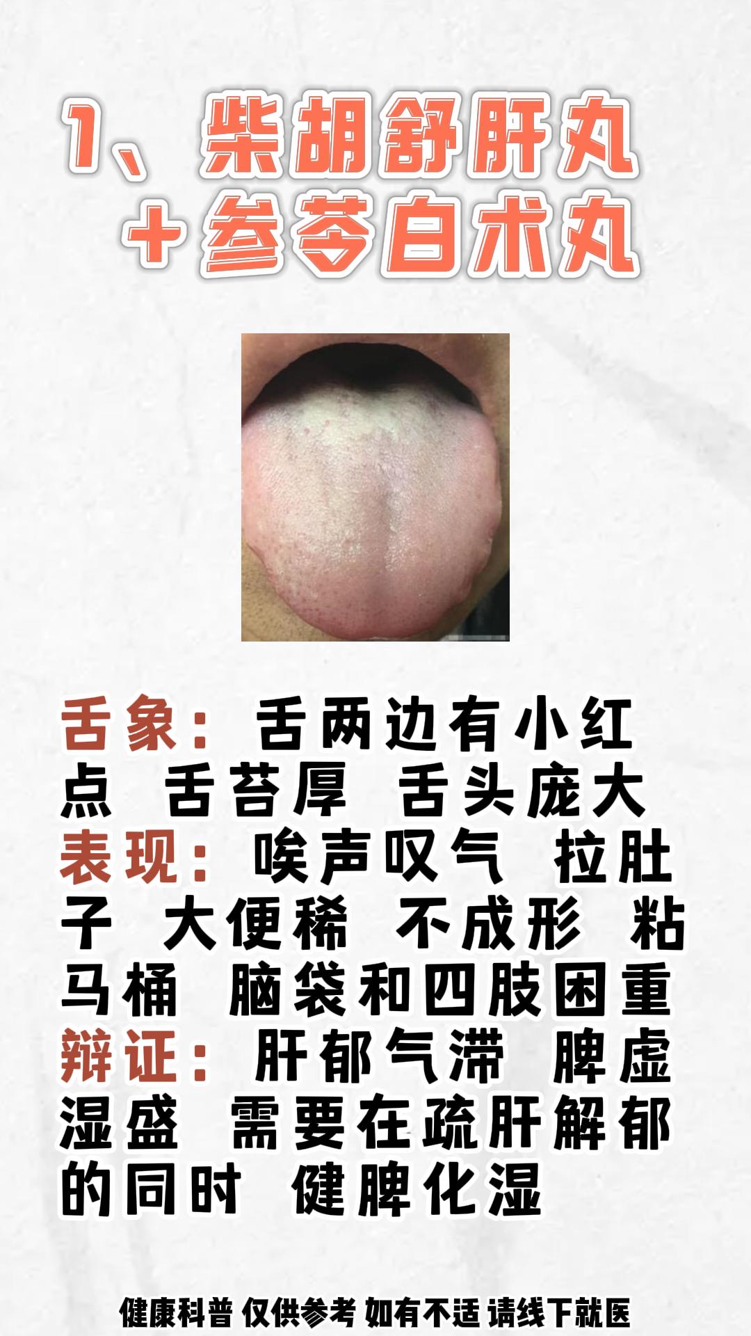 柴胡舒肝丸巧搭，适合这7类人，看舌苔有你吗？#中医##男性健康##健康科普#