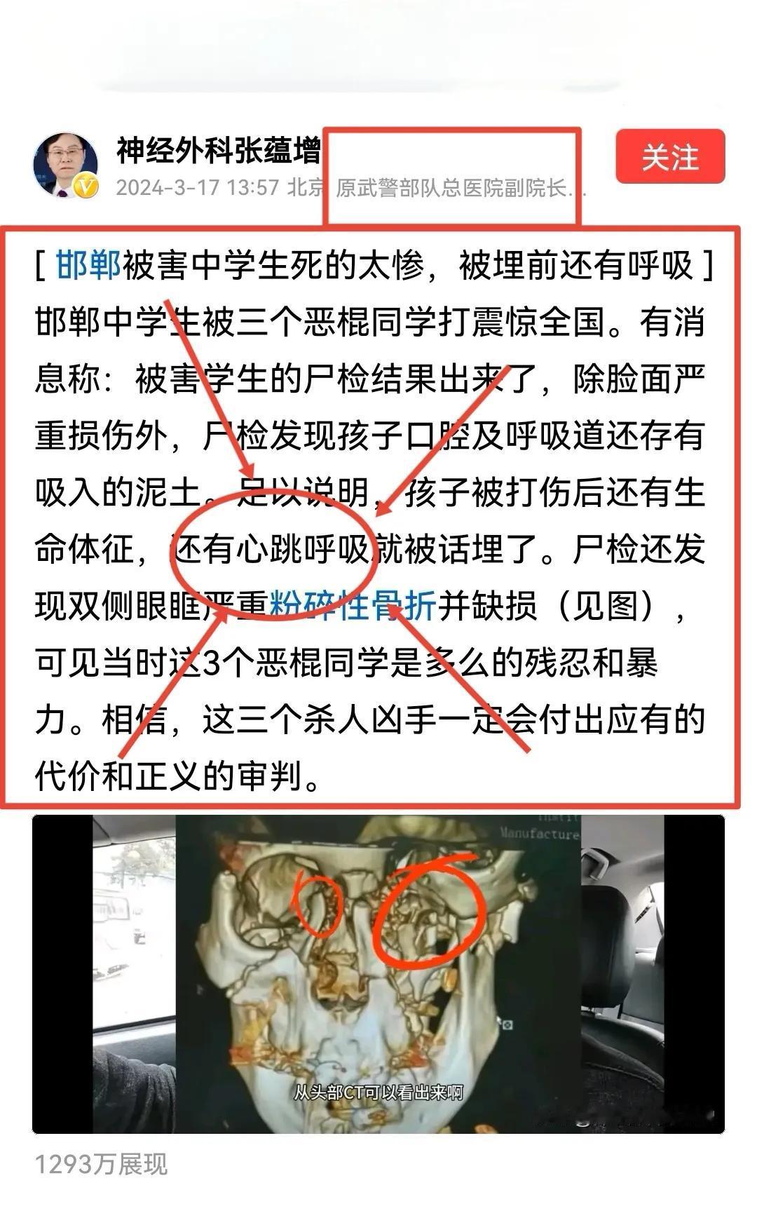 太震惊了！原武警医院副院长发文揭露：邯郸中学生被埋前还有呼吸，凶手竟如此残忍

