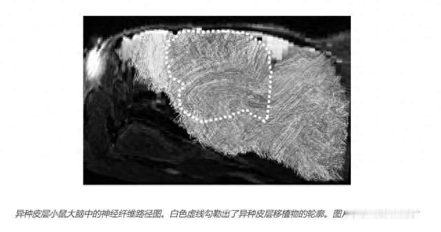 类器官移植小鼠实现神经回路整合，脑机接口基础研究再获支撑
