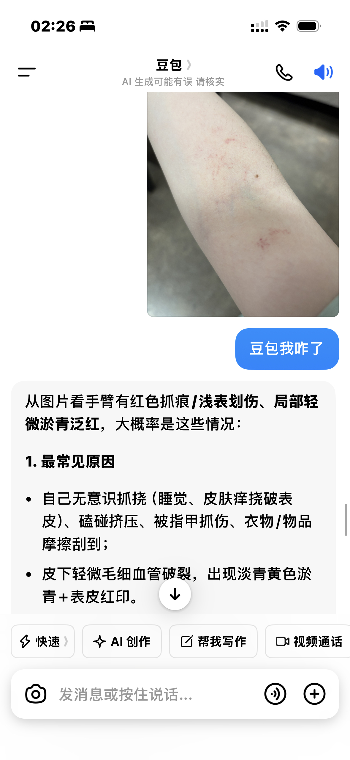 吓我一跳突然出现淤血 
