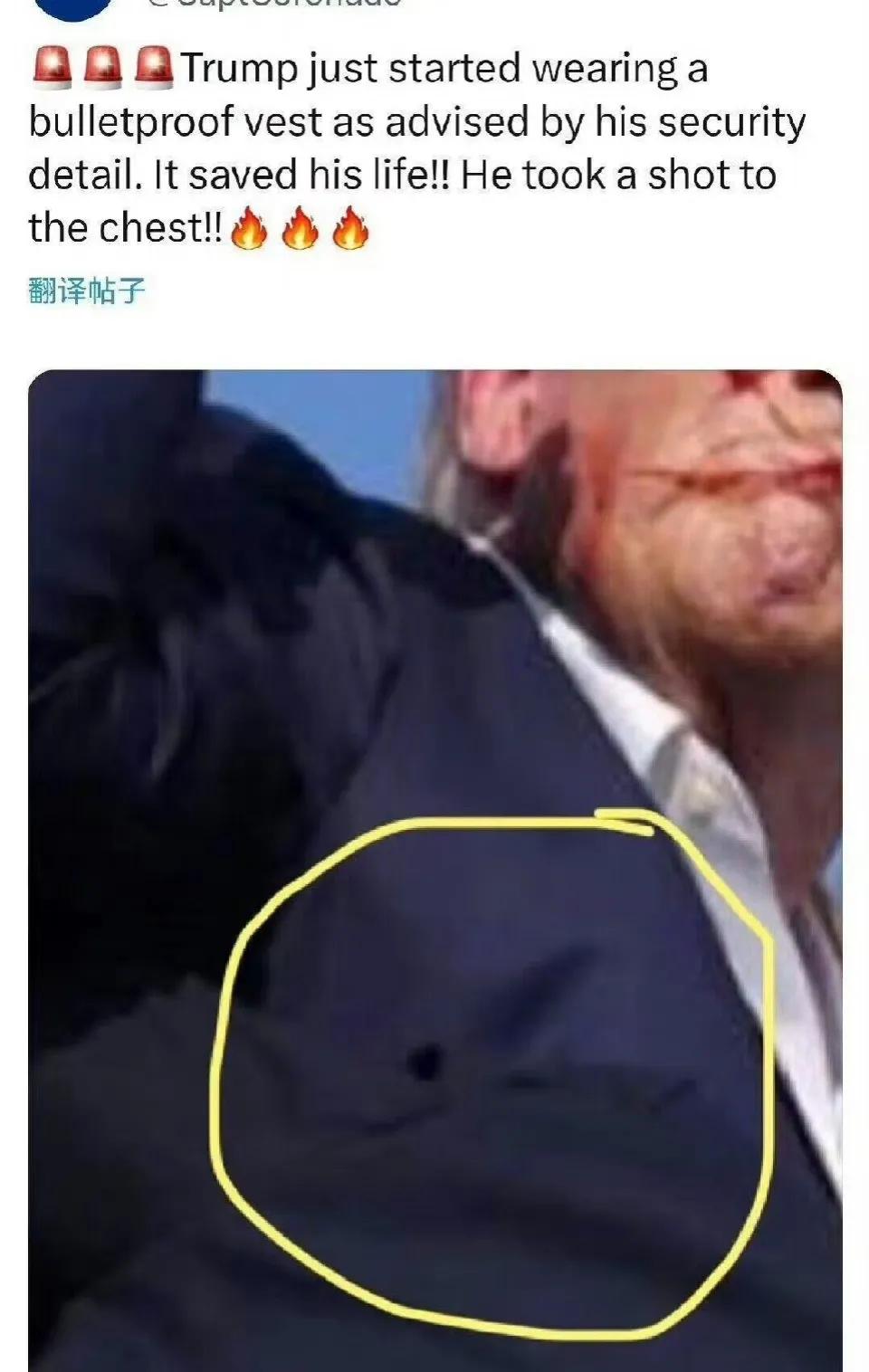 枪手其中打中了心脏，但是穿了防弹衣。紧接着第二枪爆头，可惜只打中耳朵，第三枪放空