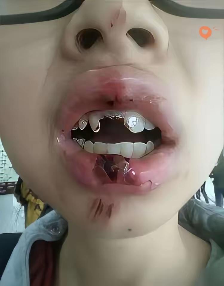 被人打了，要多少合适，还能恢复吗[捂脸]