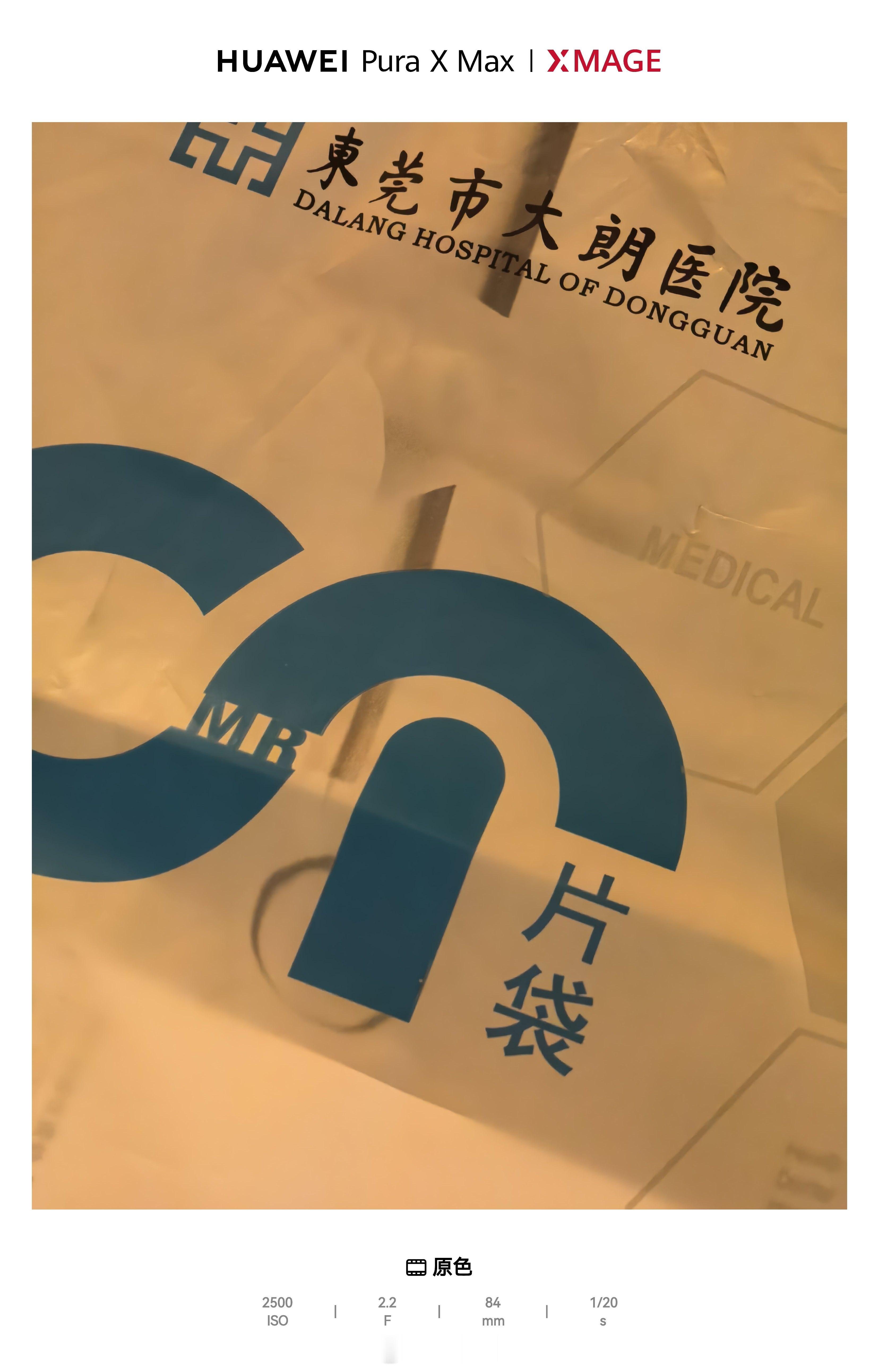 大晚上去医院拍片，还好有哥哥姐姐们的陪伴，要不一个人会害怕，没伤到骨头就好