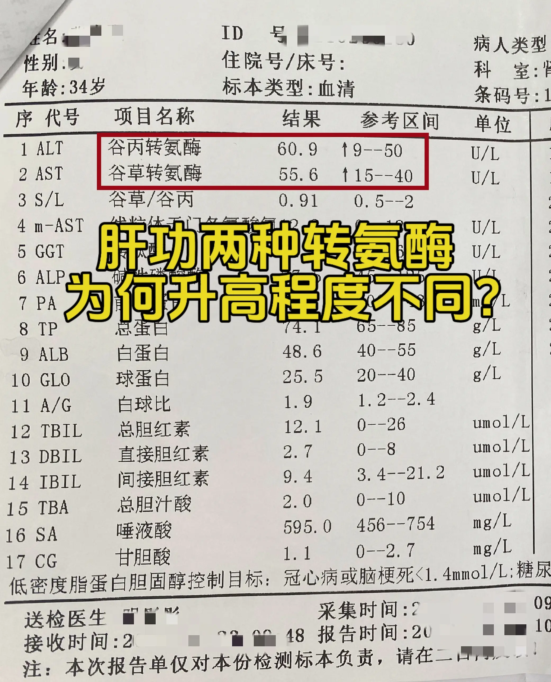 定期去复查的肝病患者应该能发现自己肝功能报告单上的两种转氨酶升高的程度...