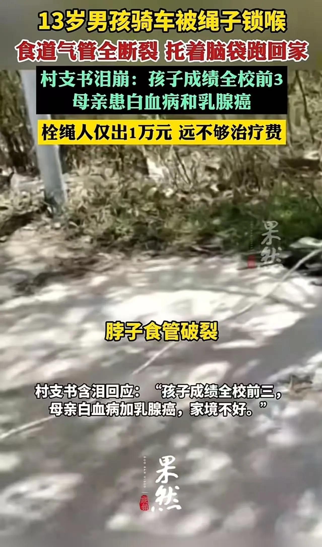 13岁男孩骑车上路，被一根横在路中央的绳子直接锁喉，气管断裂、食道撕裂、喉返神经