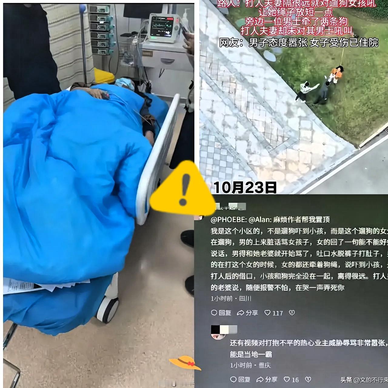 重庆遛狗女子被打后续太气人
真不是没牵绳或狗吓人
就因为狗绳长了点，竟成被打的理