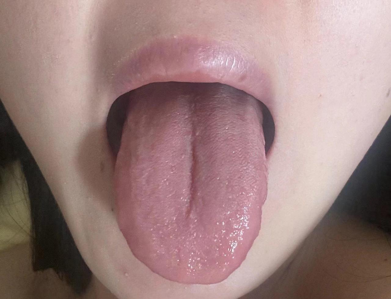 偶尔失眠，偶尔便秘，偶尔脾气大
今天这一位患者，上来自述，就是浑身哪哪都不舒服，