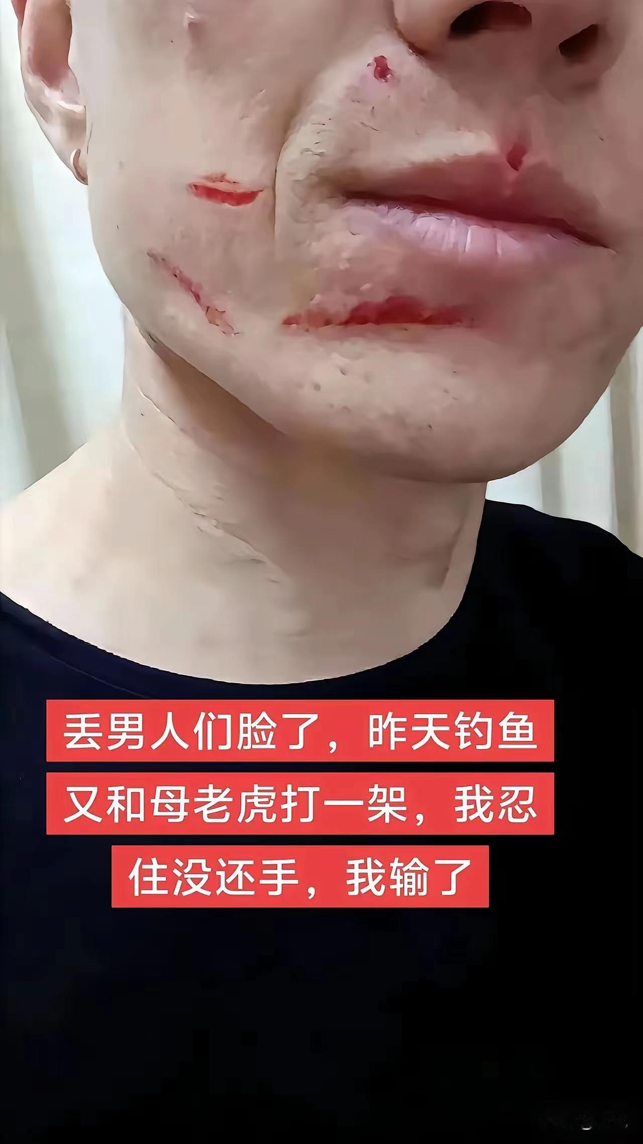 钓鱼佬就该打！
男子小金是个钓鱼爱好者，昨天，小金钓鱼回来就被老婆铲了两耳光，小