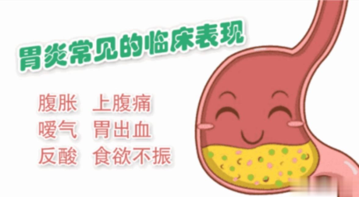 治疗慢性胃炎，我推荐3个神方1，寒热错杂——半夏泻心汤：心下痞、吐酸、打嗝、胃胀