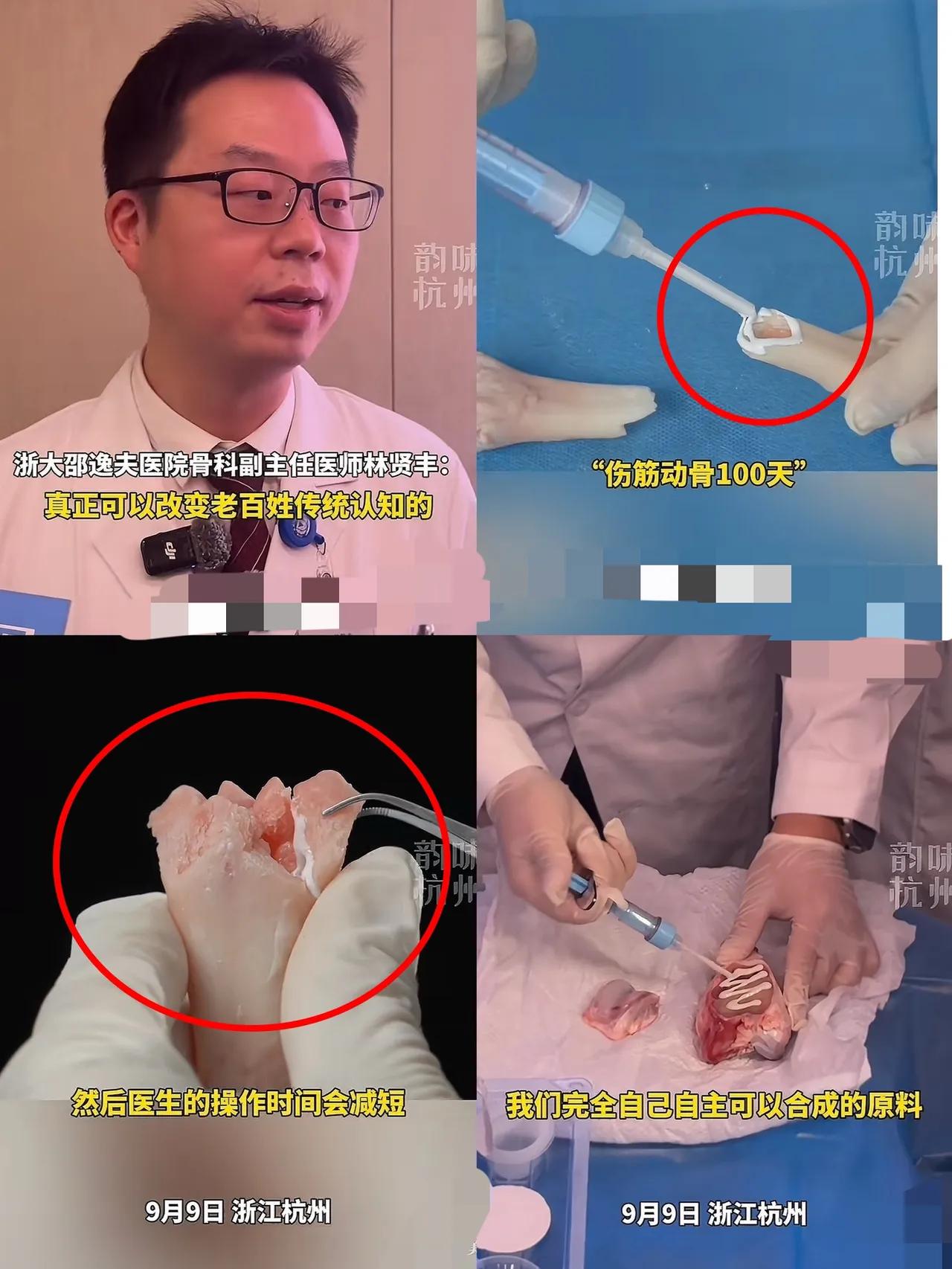 中国医疗又出王炸了！
这次直接把全世界都给惊到了！
      浙江邵逸夫医院搞