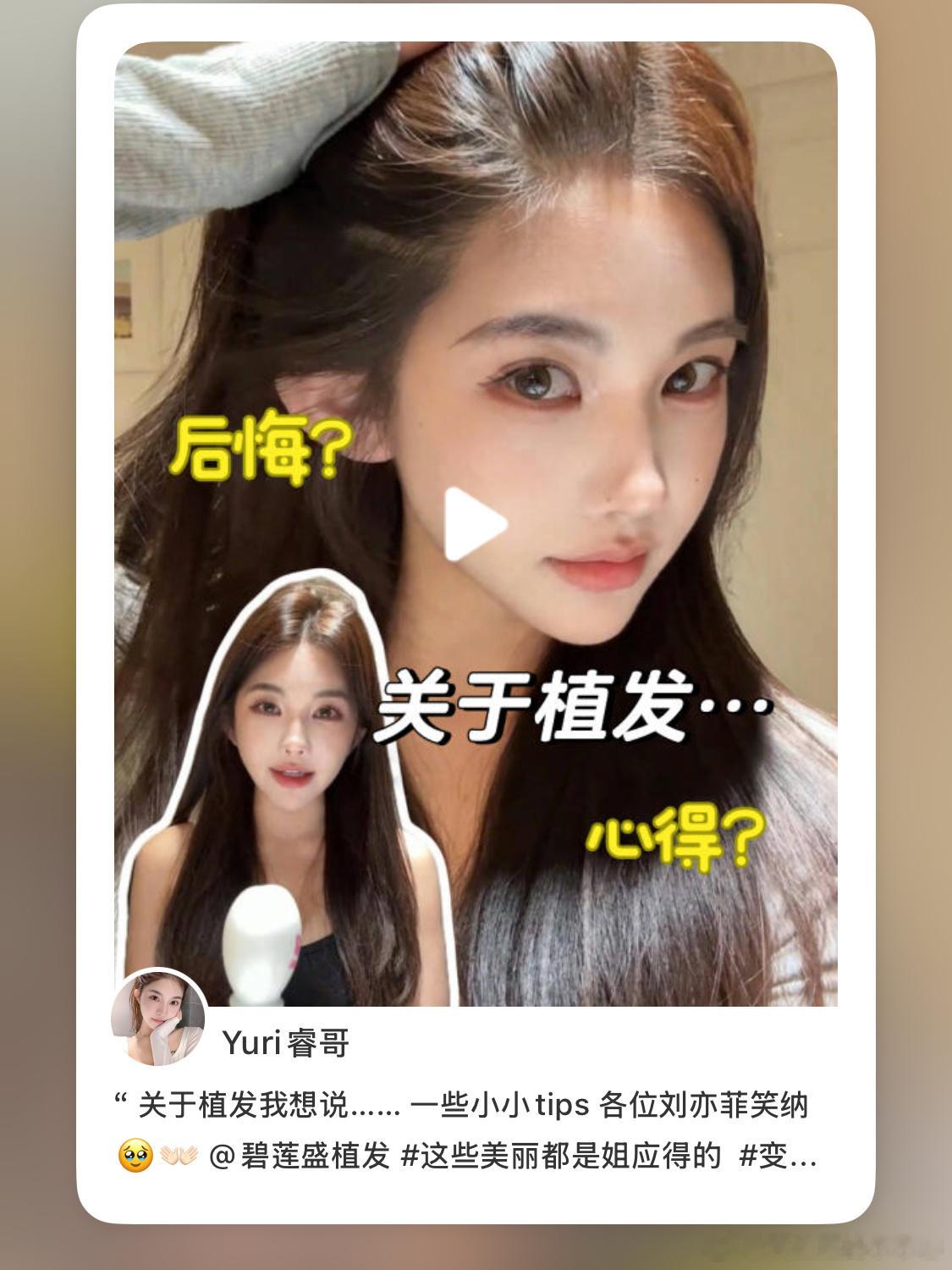 老婆们 植发心得已发 两个平台都发了🍠抓1位老婆200美发基金🧧～～ ​​​
