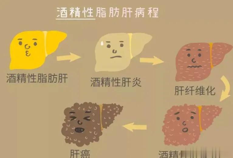 酒精肝的7大症状表现，看看爱喝酒的你有没有1. 体重下降体重下降是酒精肝一个很常