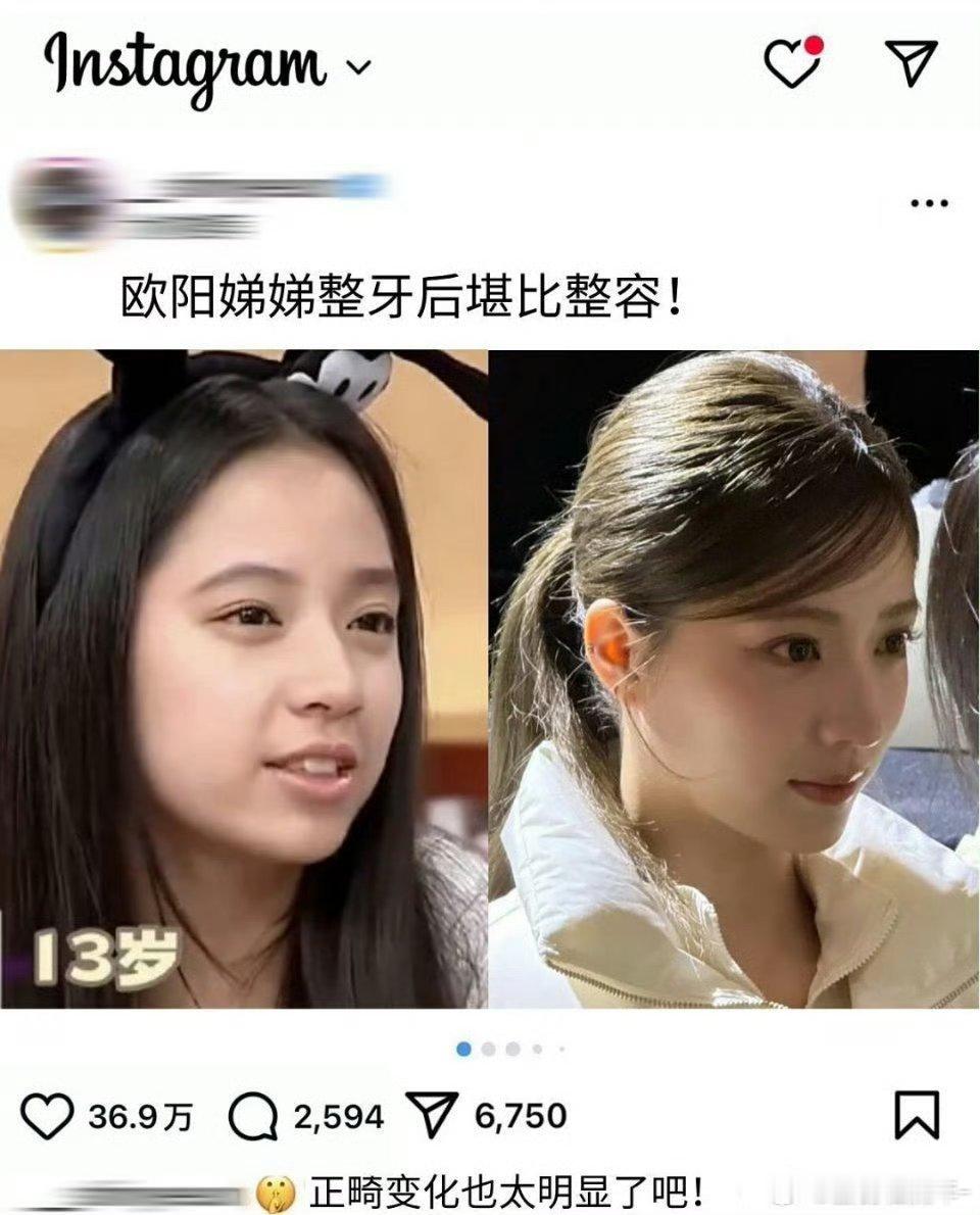 欧阳娣娣整牙后变化超大，就像整容一样，牙齿变整齐，颜值也提升，整个人都更漂亮多了