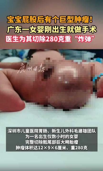 “太让人揪心了！”深圳，一名刚刚出生的女婴，骶尾部藏着一枚重达280克的巨型畸胎