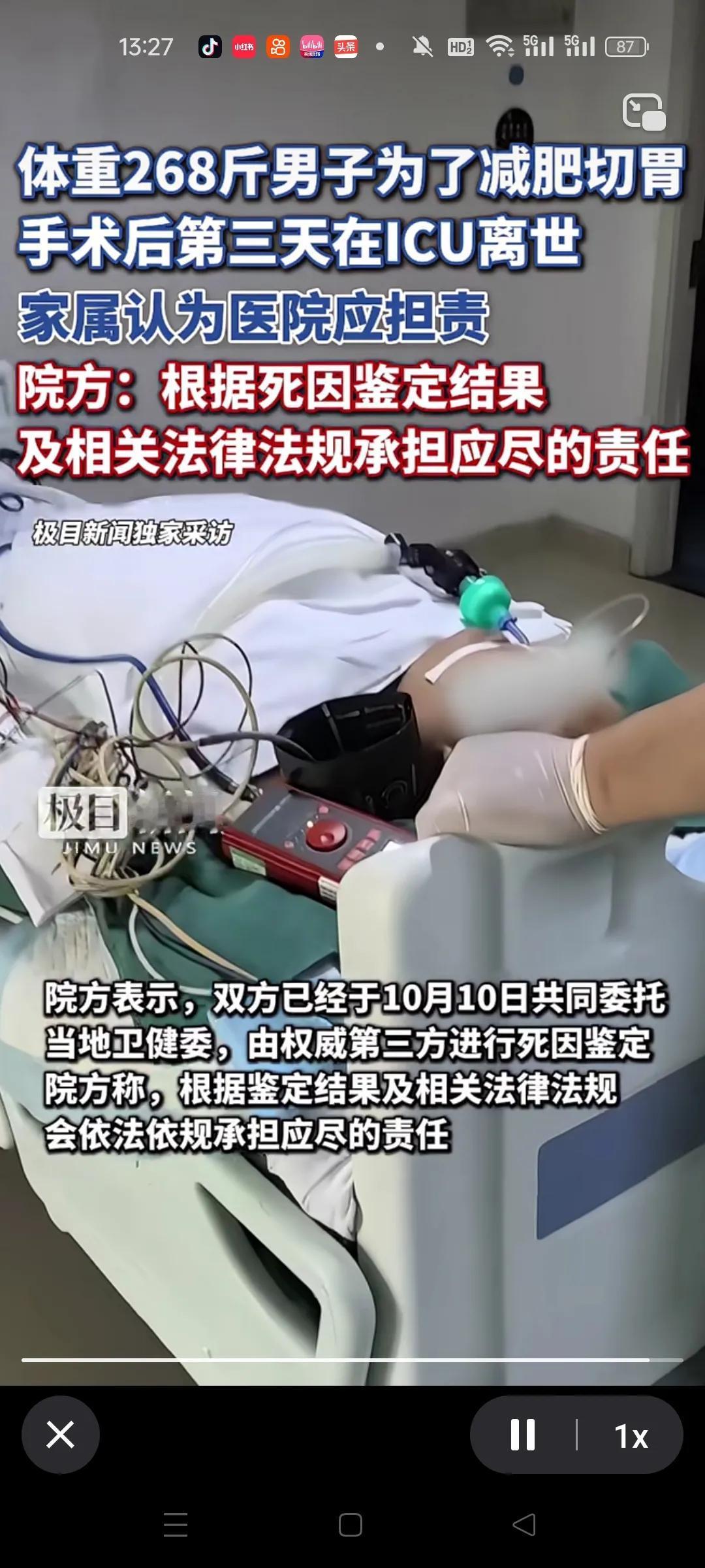 根源它就不在胃，就算切一半去，它是有弹性的，时间长了管不住嘴，该胖还是胖，为什么