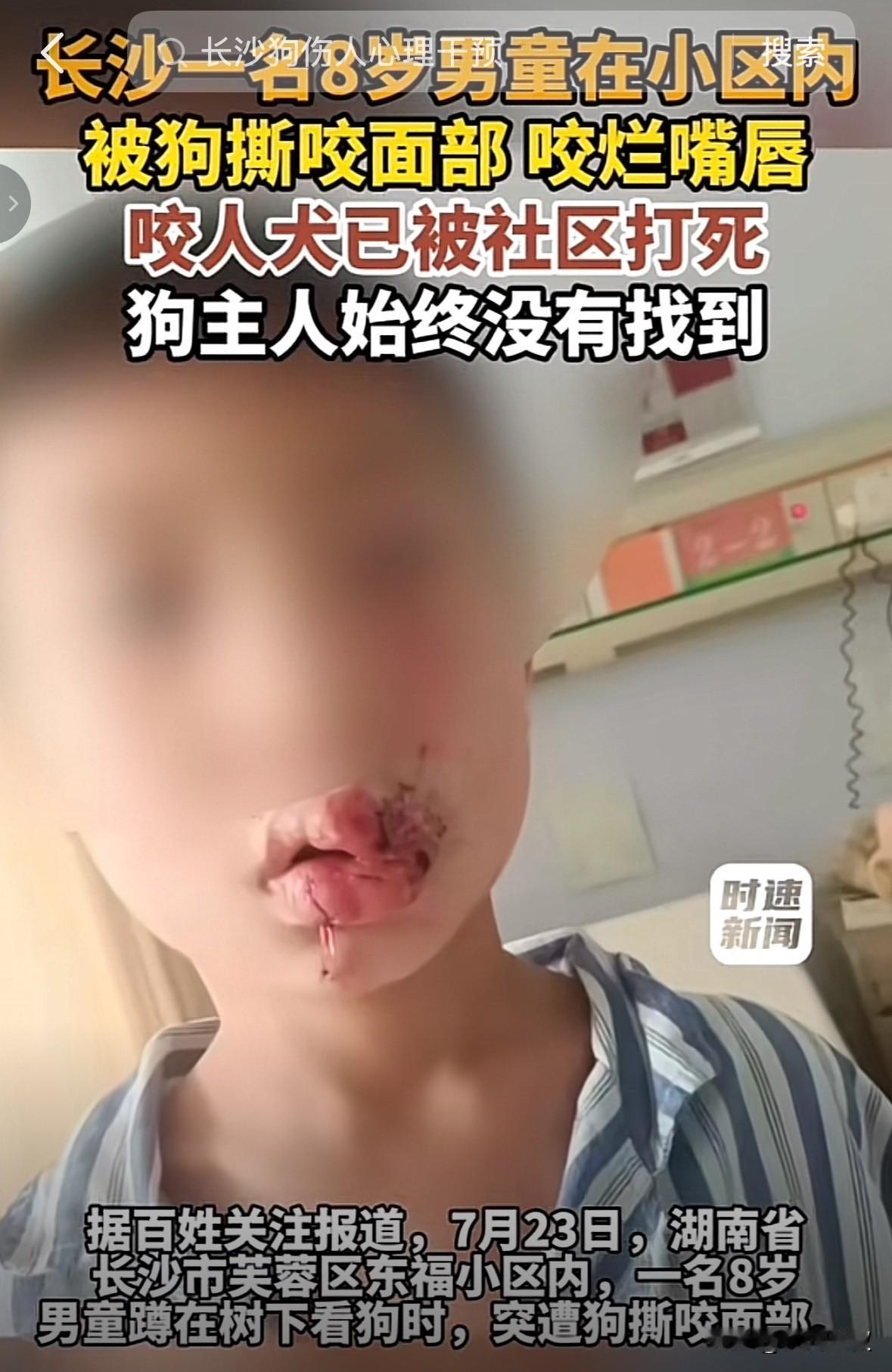 好心疼！长沙8岁男孩被狗咬烂嘴唇，却找不到狗主人。

小男孩只是蹲在树下看狗，谁
