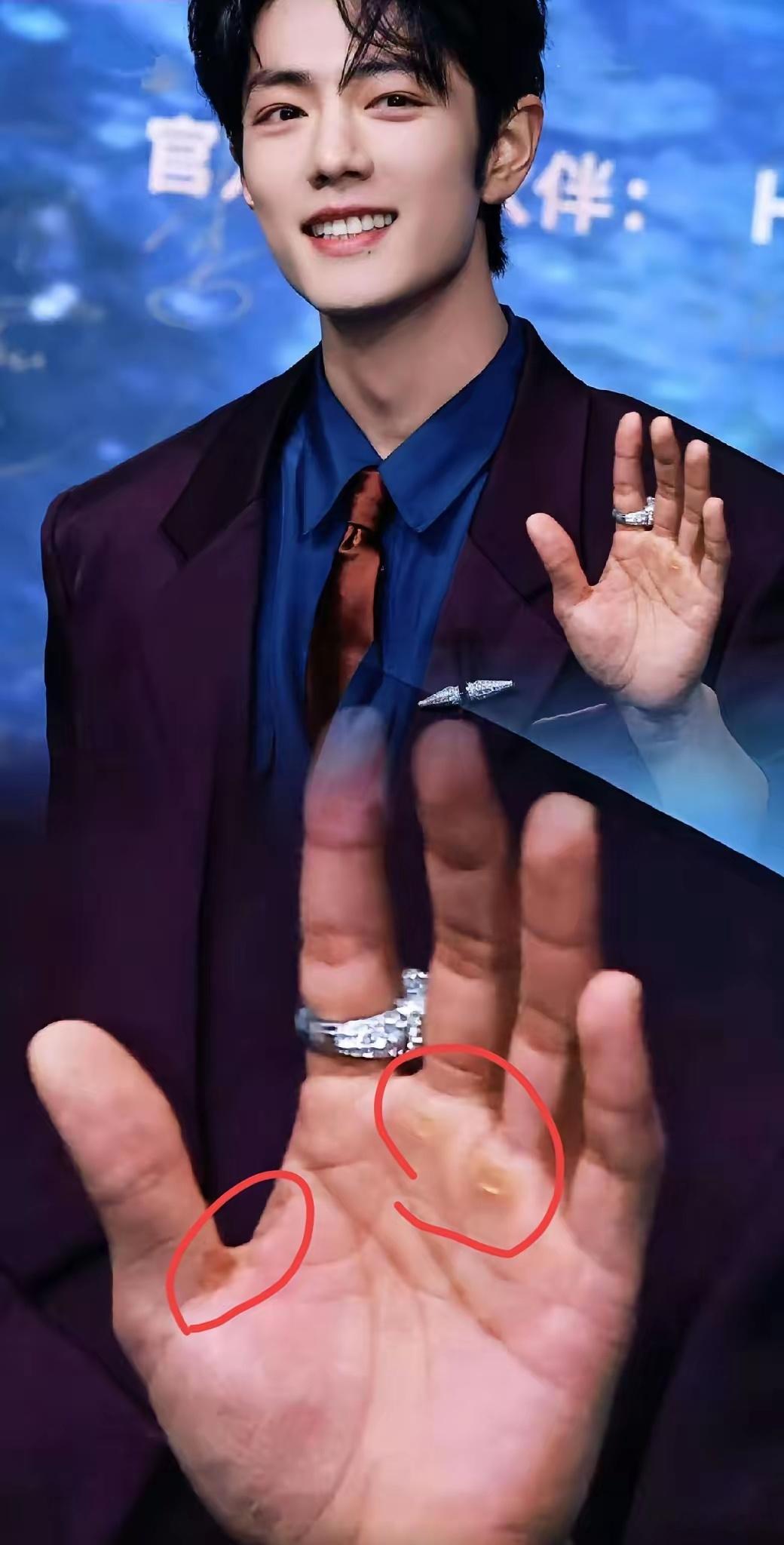 你可以说我肤浅，也可以说我没见识，但我是真的不敢相信，帅气的肖战，他的手居然如此