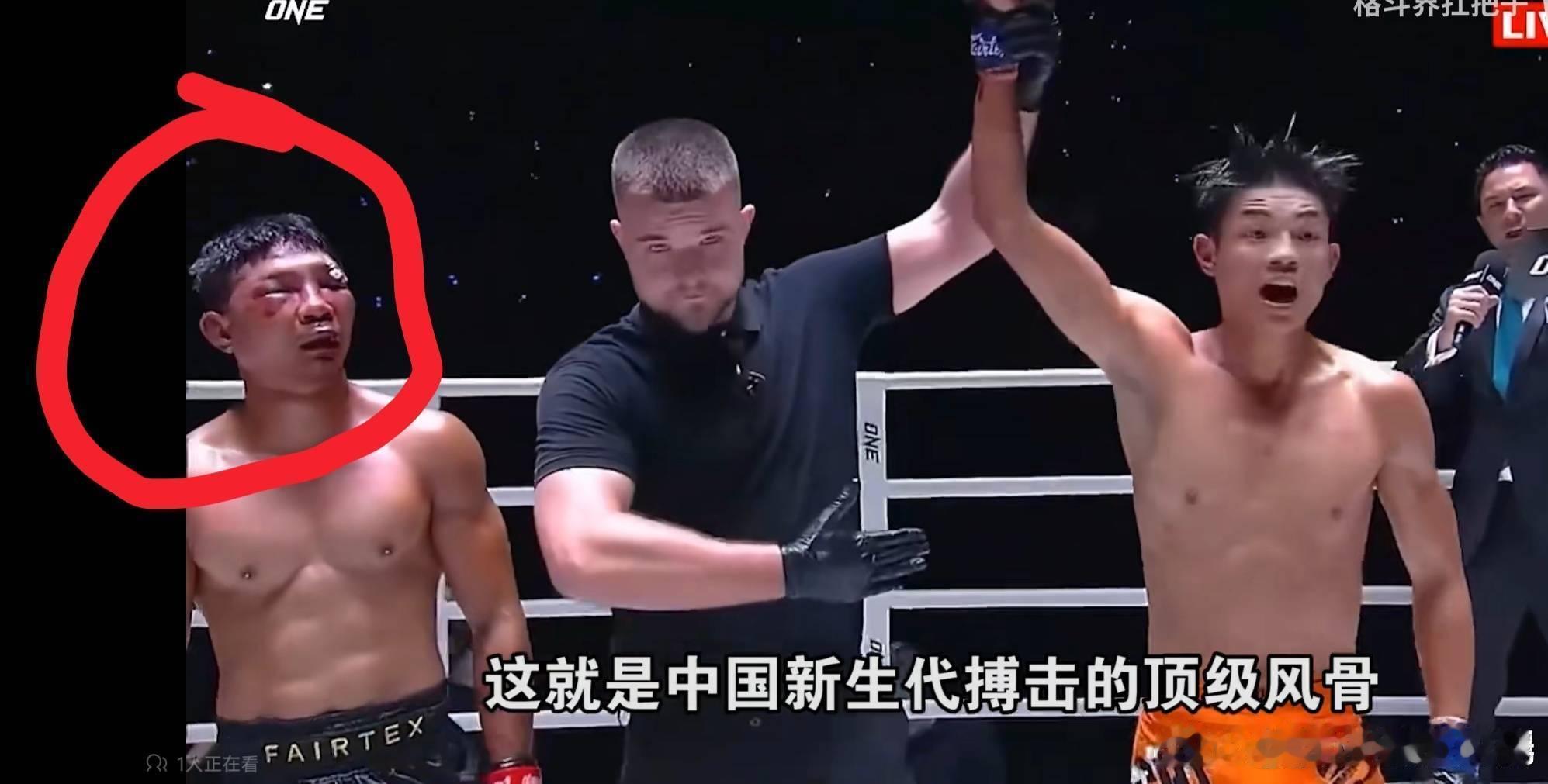 泰国拳王佩查钦被中国小将魏子钦揍成猪头中国功夫就是牛 泰国旅游局 泰拳泰国国家旅
