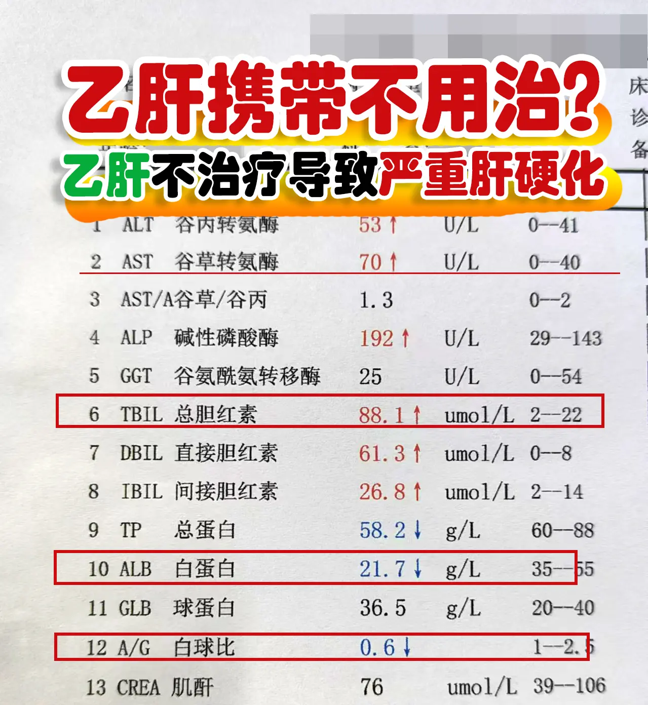 前两天接诊了一位来自山东济宁的乙肝患者，50多岁，乙肝多年，有家族史...