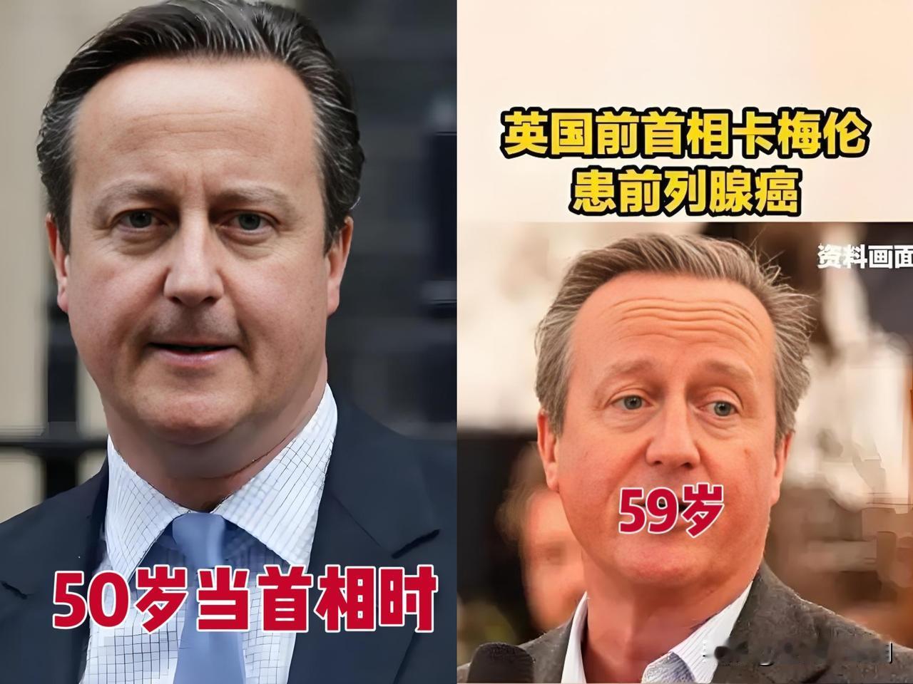 英国前首相卡梅伦自报不幸患前列腺癌…

卡梅伦现年59岁，于2010至2016年