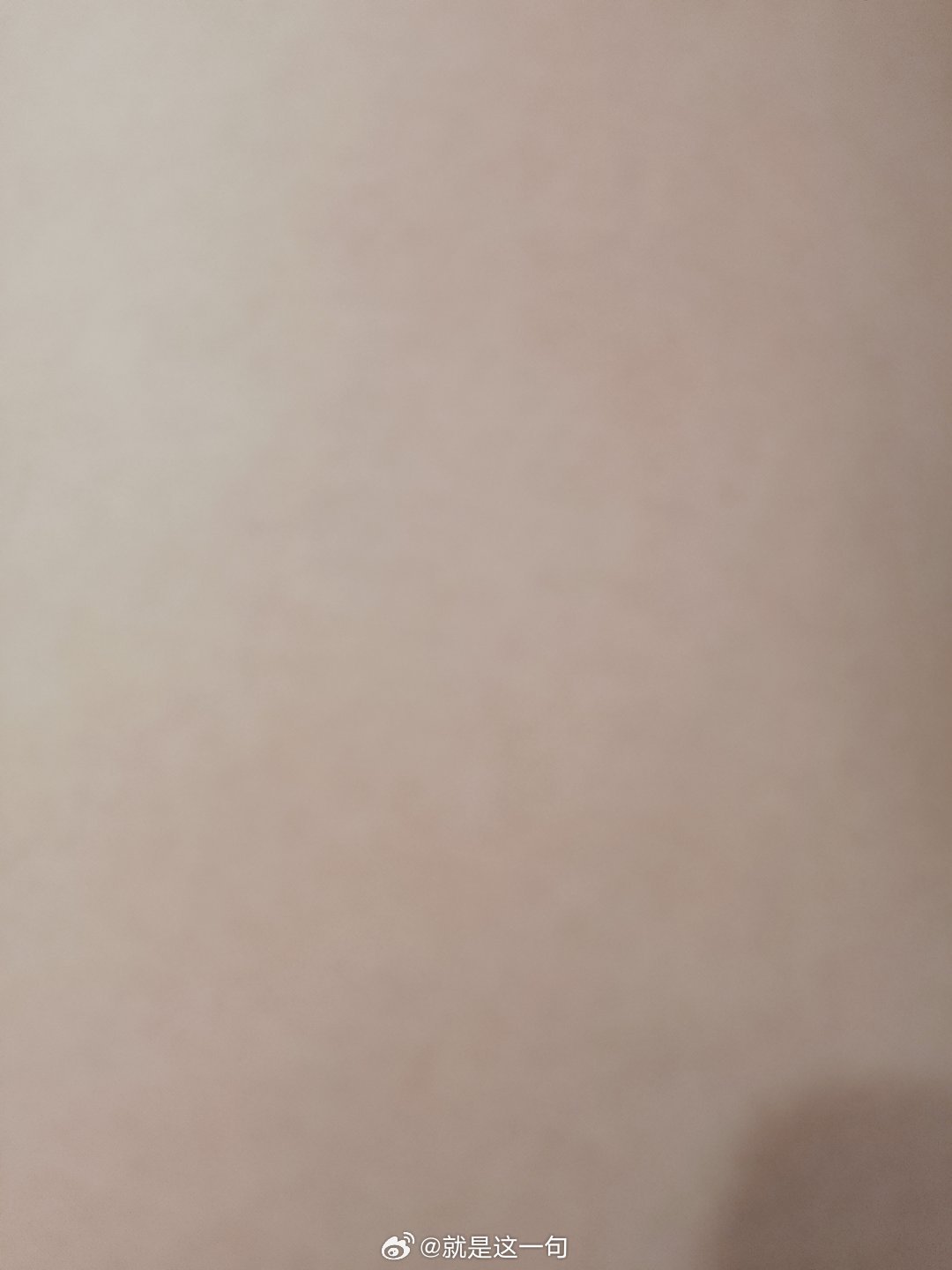 莫名其妙的大腿内侧好痛，特别是筋更痛