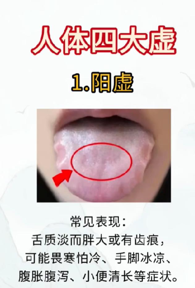 看舌辨体质！阳虚、气虚、血虚、阴虚，一眼分清