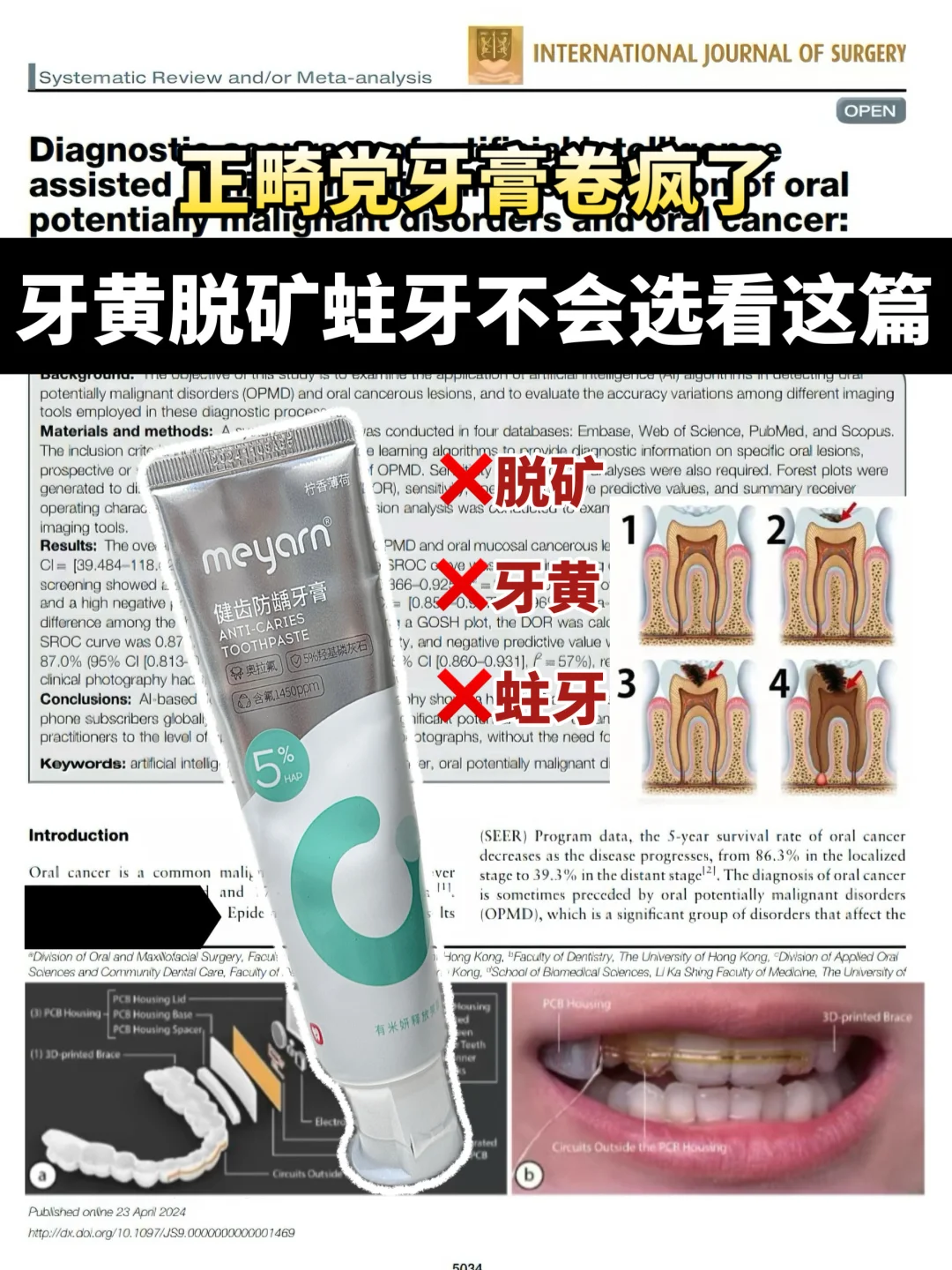 含氟牙膏卷疯了！咱们正畸人真是越吃越好