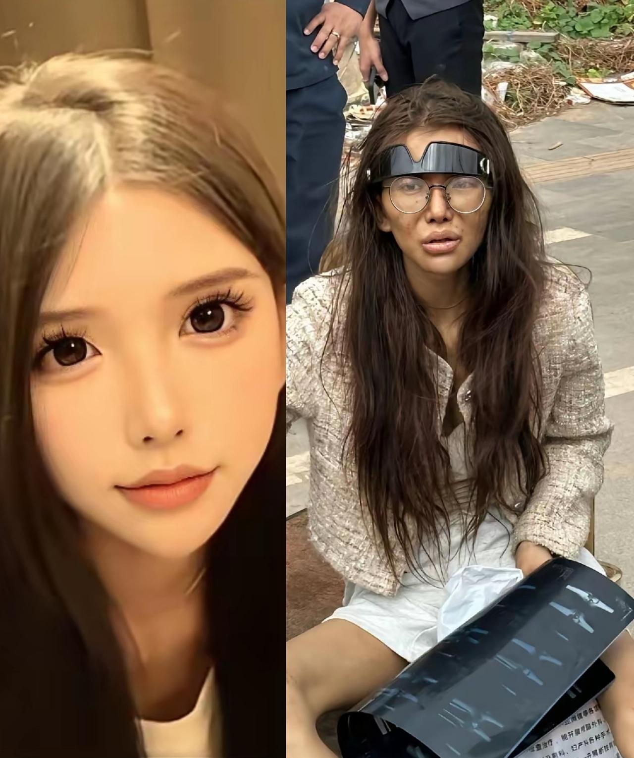 福建一女网红去东南亚某国淘金，最后变成了照片中的模样，真是令人唏嘘和惋惜！

这