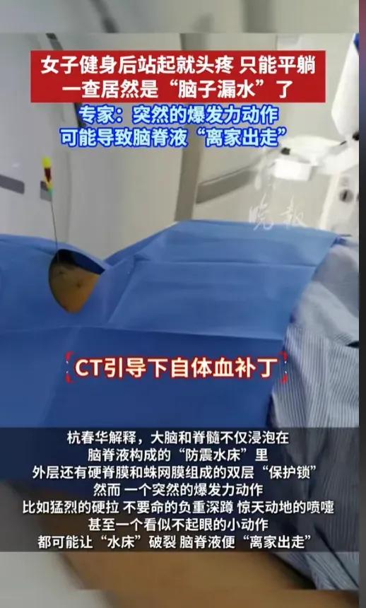万万没想到啊！6月29日，江苏南京，一女子健身之后患上了个怪病，一站起来头就疼得