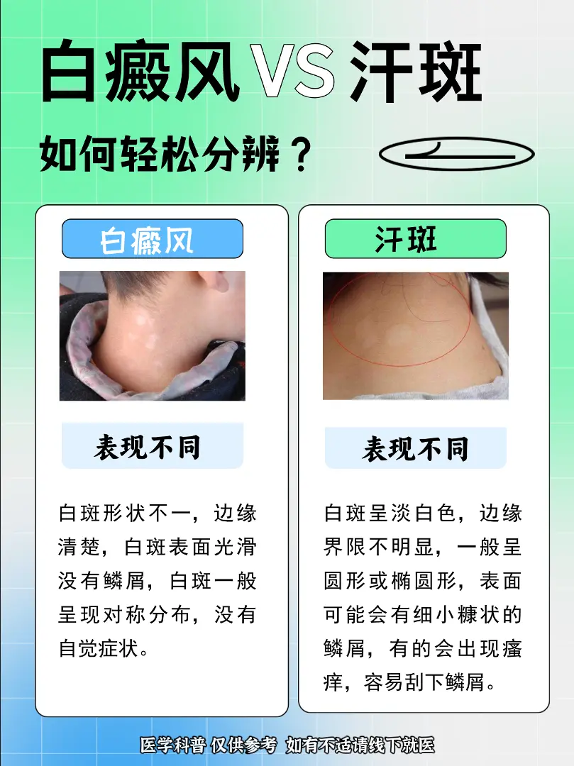 医学科普 白癜风 白斑 硬核健康科普行动  皮肤管理