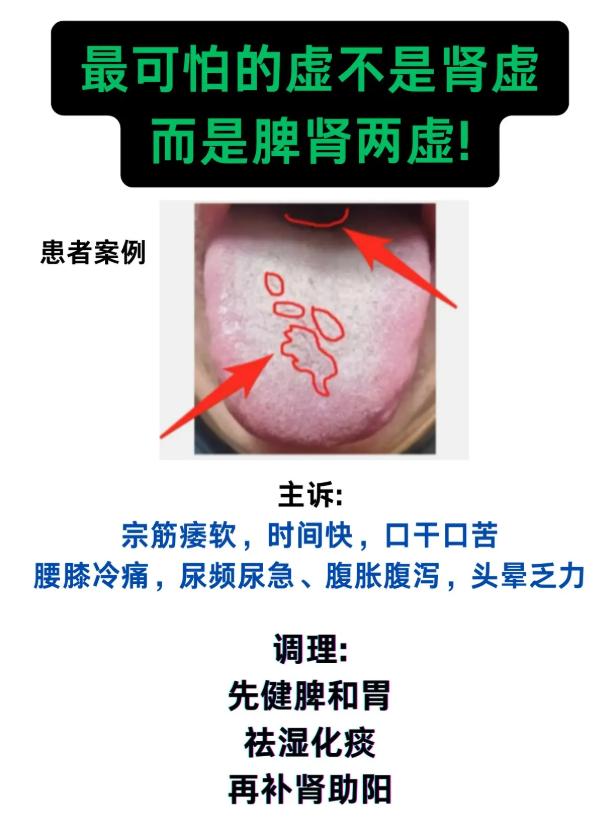 最可怕的虚，不是肾气不足，而是脾肾两虚！