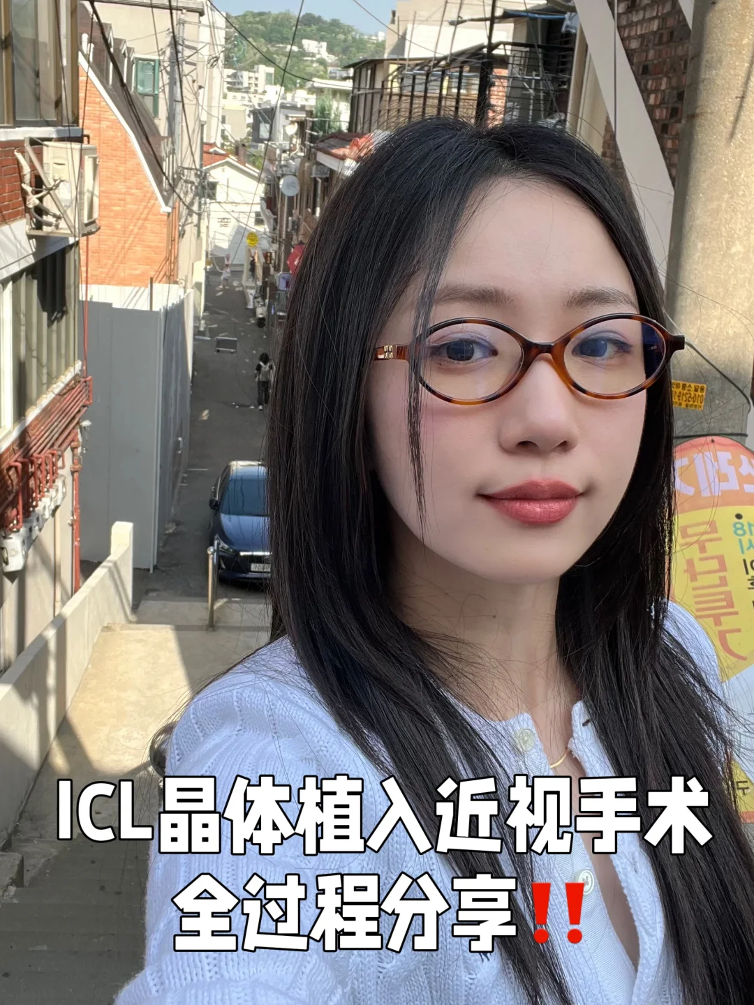 上海ICL术后全过程分享！