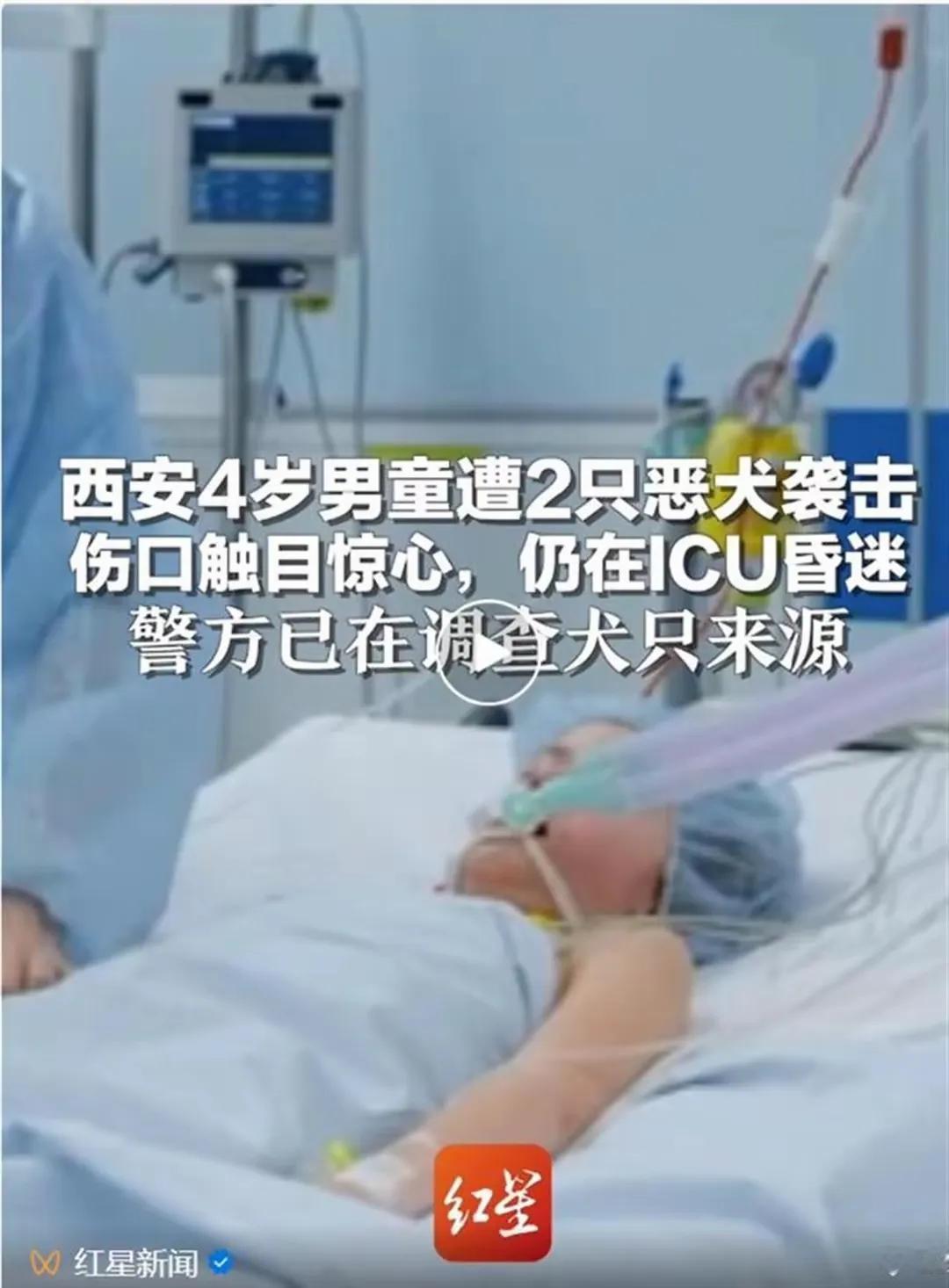 太心痛了！12.21日下午，西安灞桥区豁口村发生两个恶犬攻击四岁男童事件！目前仍