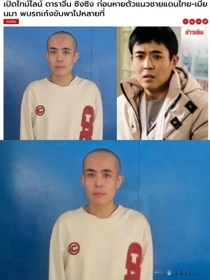 演员星星已经被剃光头了，腿上全是伤痕，女朋友是救命恩人[机智]

星星的弟弟说已