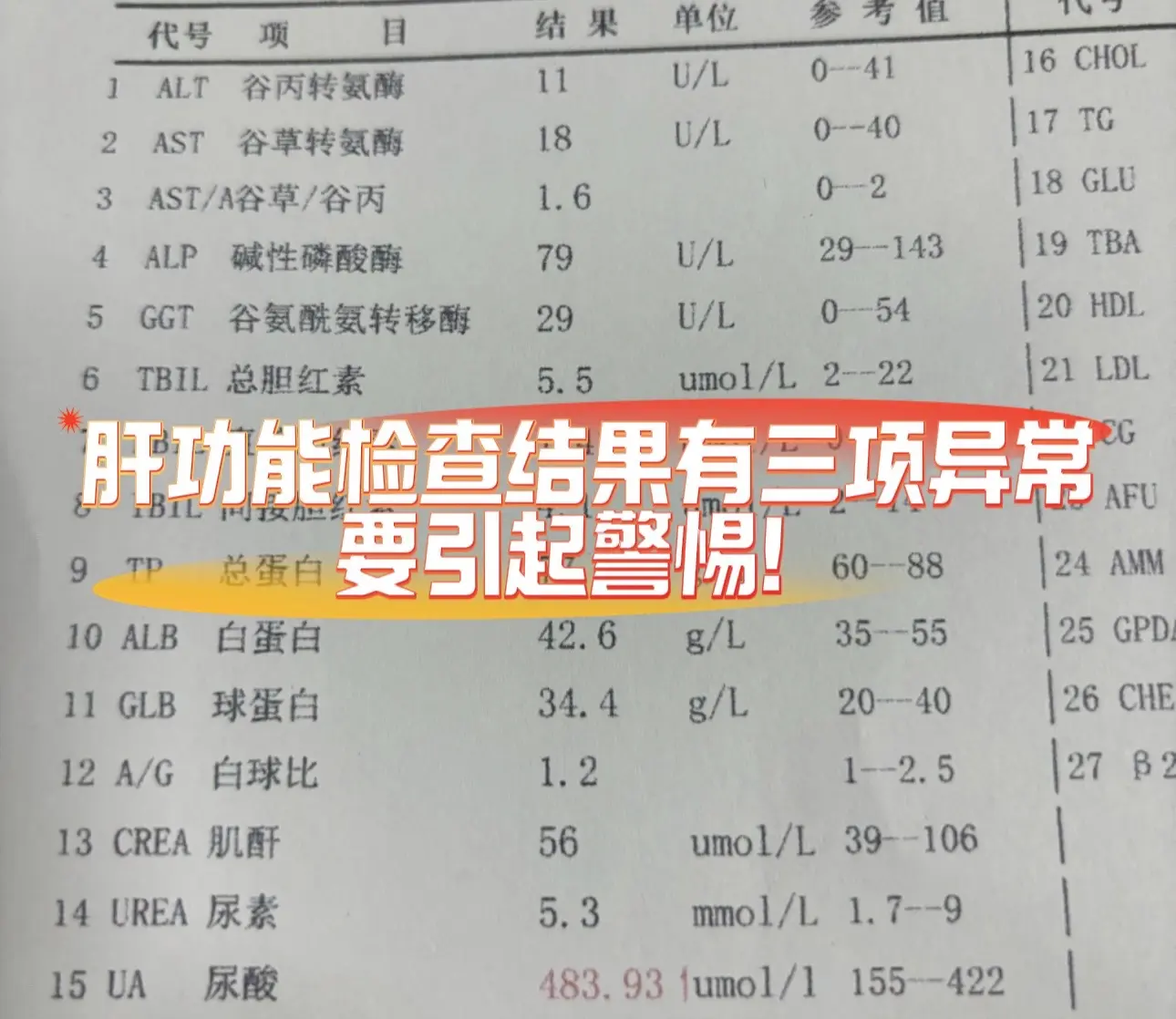 1.转氨酶。主要包括谷丙转氨酶和谷草转氨酶，主要存在于肝细胞胞浆及线粒...