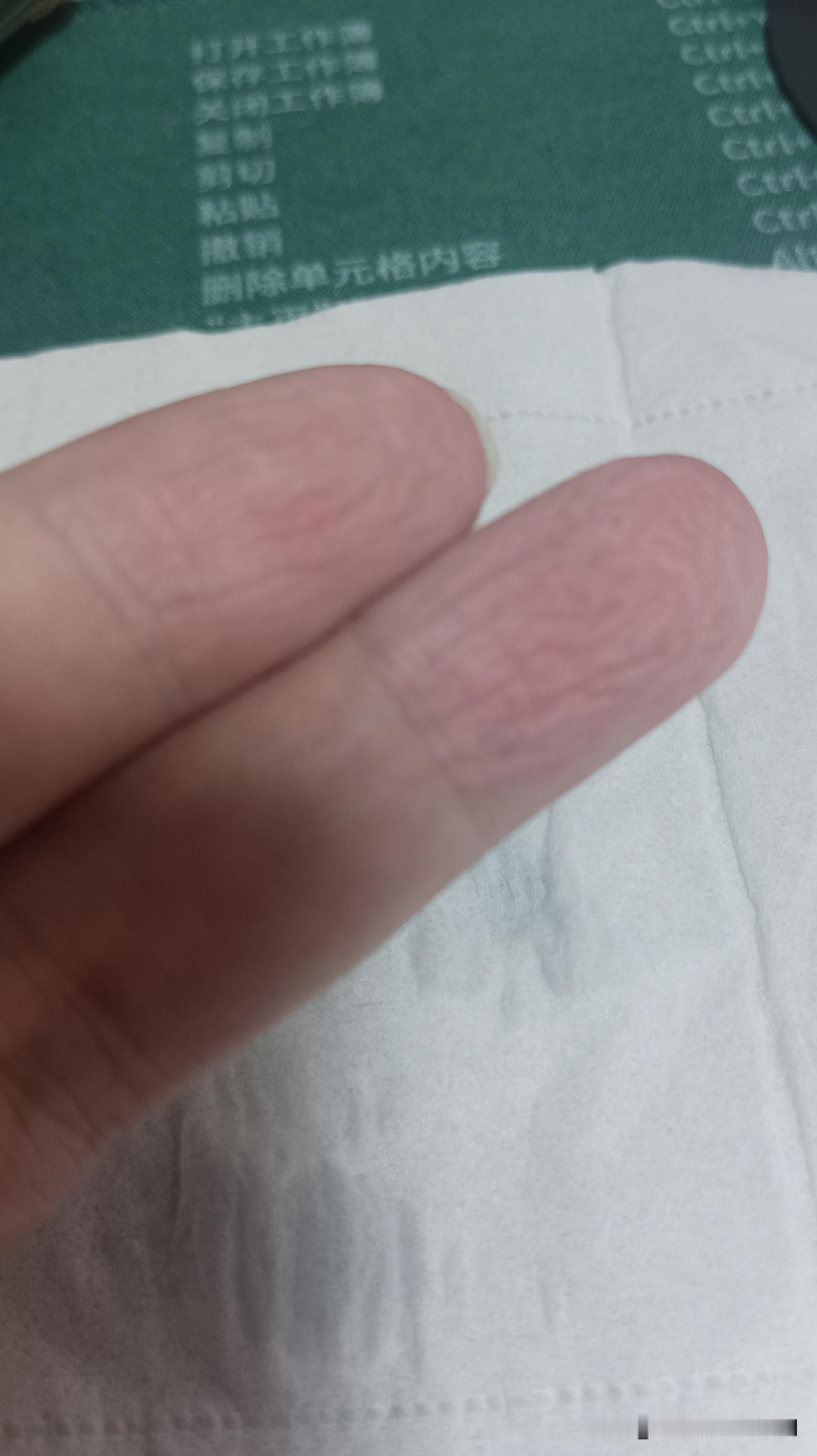 当我用手抓吃凉拌菜的时候，十几分钟过后，两根手指尖明显出现脱水现象。从生物学角度