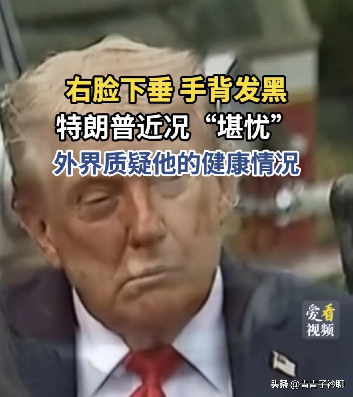 懂王、建国、“两周先生”特朗普最近有点烦，第一，略微中风，从脸部蠕动可以判断，基