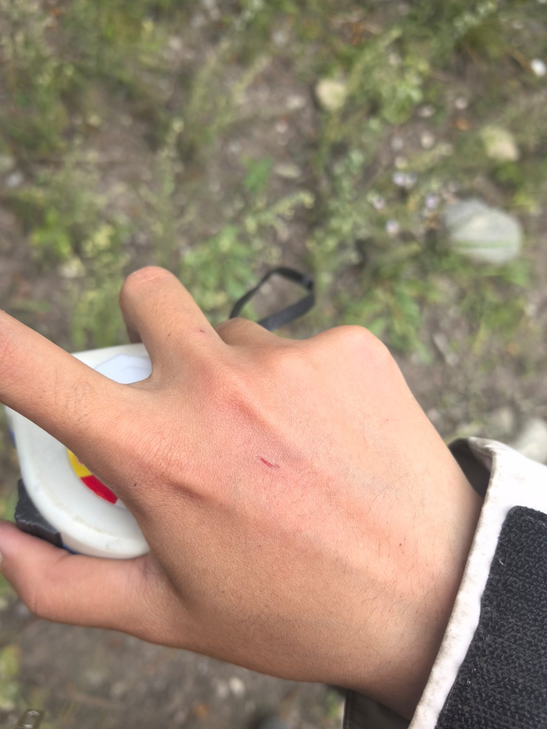 无意卖惨但这就是我的日常 