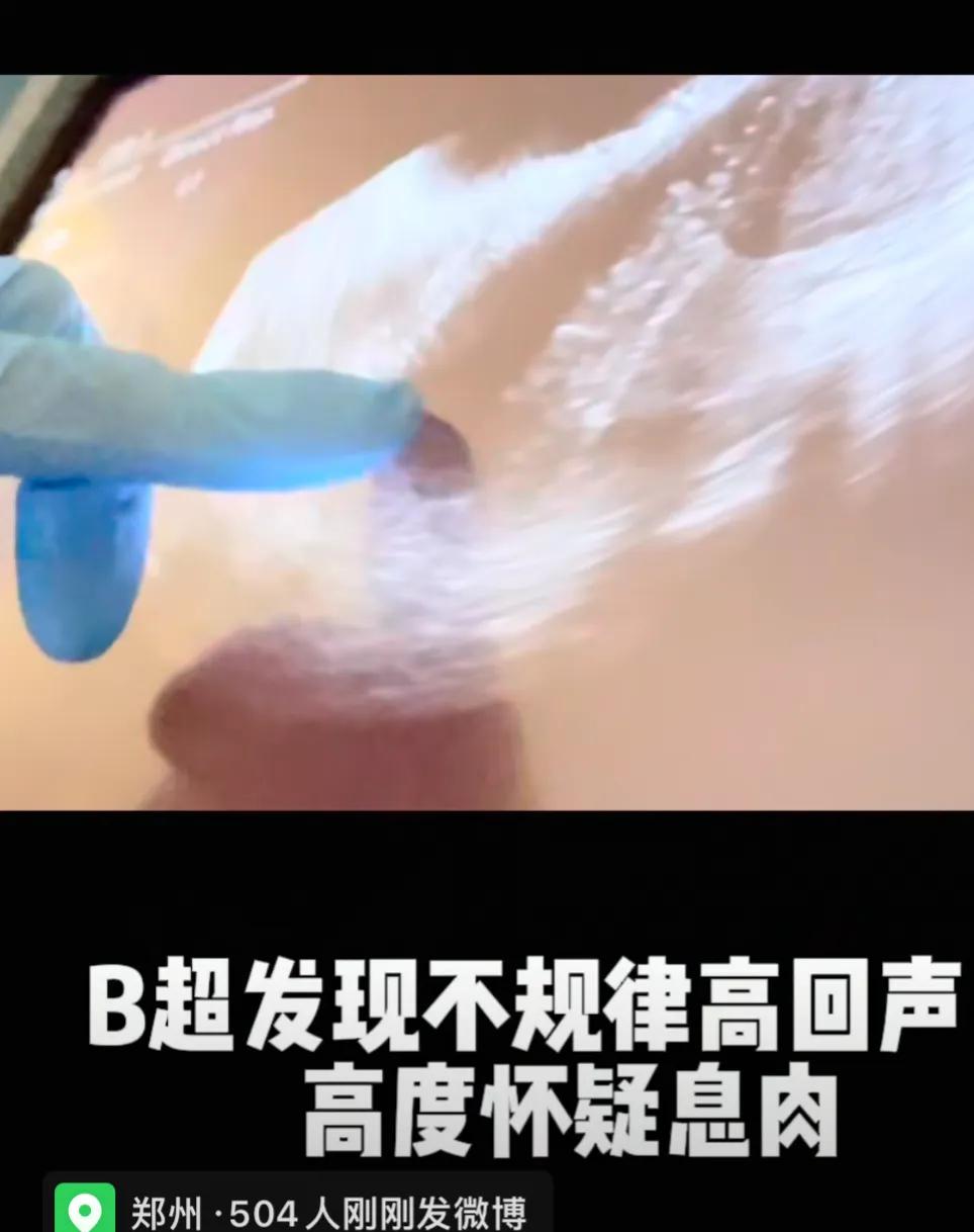35岁张萌多次备孕失败，粉丝替其出招：有个秘方，不要买那种很贵的叶酸啥的，就去社