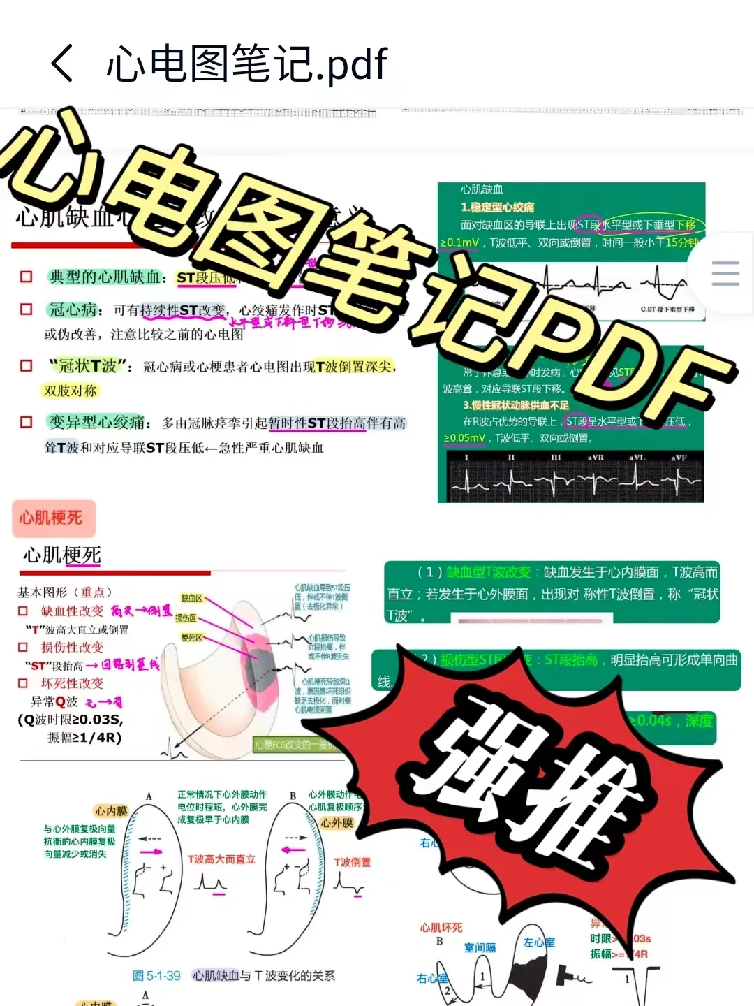 心电图笔记PDF🔥！！