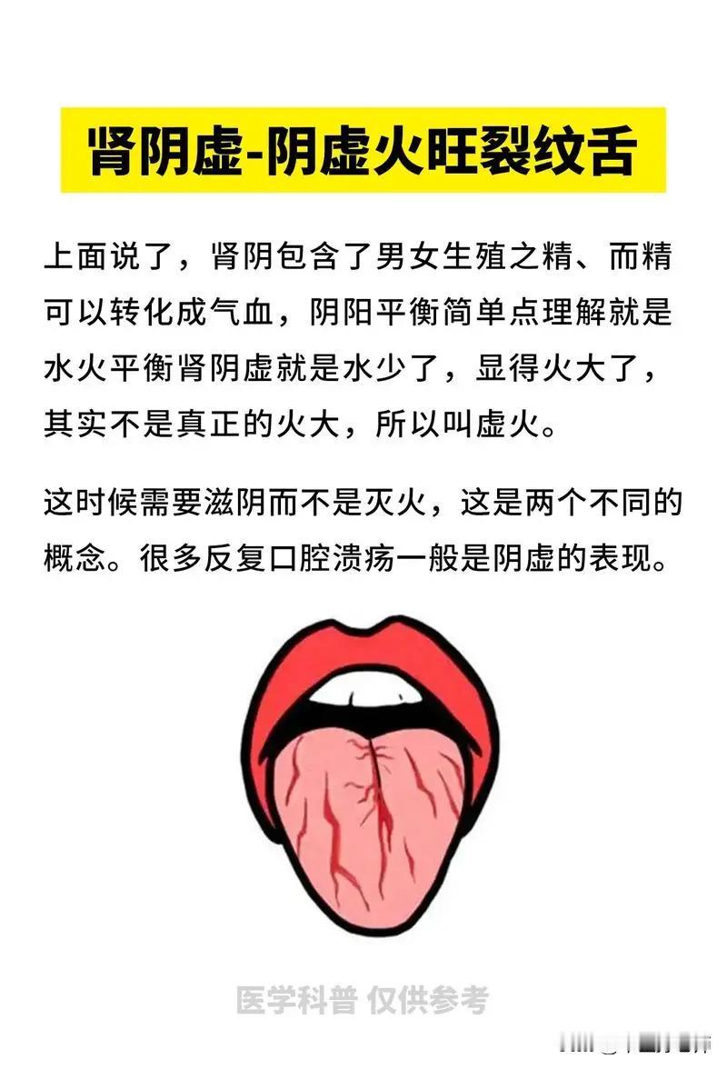 舌头有裂纹，是什么原因造成的，你知道吗？#健康##舌象分析#