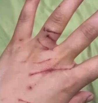 养猫养出祸害！北京的陈女士养了一猫，没想到在清理猫砂时，遭到突然袭击，造成颅部3